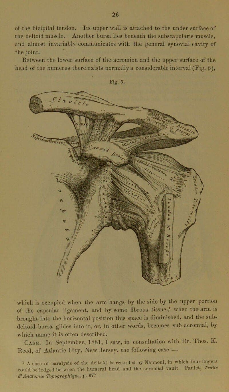 of the bicipital tendon. Its upper wall is attached to the under surface of the deltoid muscle. Another bursa lies beneath the subscapularis muscle, and almost invariably communicates with the general synovial cavity of the joint. Between the lower surface of the acromion and the upper surface of the head of the humerus there exists normally a considerable interval (Fig. 5), Fig. 5. which is occupied when the arm hangs by the side by the upper portion of the capsular ligament, and by some fibrous tissue;1 when the arm is brought into the horizontal position this space is diminished, and the sub- deltoid bursa glides into it, or, in other words, becomes sub-acromial, by which name it is often described. Case. In September, 1881, I saw, in consultation with Dr. llios. K. Reed, of Atlantic City, New Jersey, the following case:— 1 A case of paralysis of the deltoid is recorded by Nannoni, in which four fingers could be lodged between the humeral head and the acromial vault. Paulet, lYaite d’Anatomie Topographique, p. 677
