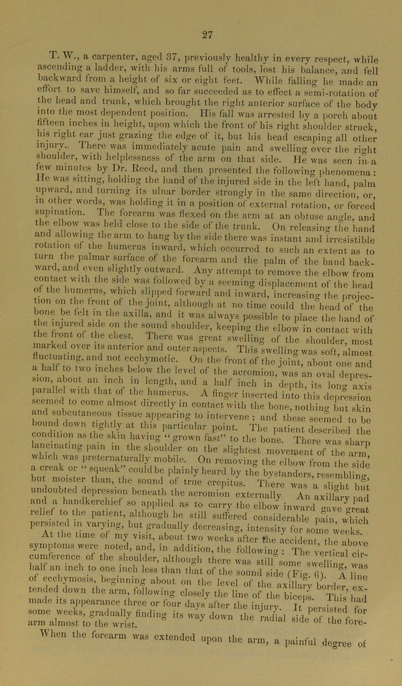 T. W., a carpenter, aged 37, previously healtliy in every respect, while ascending a ladder, with his arms full of tools, lost his balance, and fell backward from a height of six or eight feet. While falling he made an etlort. to save himself, and so far succeeded as to effect a semi-rotation of the head and trunk, which brought the right anterior surface of the body into the most dependent position. His fall was arrested by a porch about fifteen inches in height, upon which the front of his right shoulder struck, his right, ear just grazing the edge of it, but his head escaping all other in jury.. I here was immediately acute pain and swelling over the ri-ht shoulder, with helplessness of the arm on that side. He was seen in-a few minutes by Dr. Reed, and then presented the following phenomena: He was sitting, holding the hand of the injured side in the left hand, palm upward, and turning its ulnar border strongly in the same direction, or, in other words, was holding it in a position of external rotation, or forced supination. The forearm was flexed on the arm at an obtuse umde, and the elbow was held close to the side of the trunk. On releasing the hand and allowing the arm to hang by the side there was instant and irresistible rotation of the humerus inward, which occurred to such an extent as to turn the palmar surface of the forearm and the palm of the hand back- ward, and even slightly outward. Any attempt to remove the elbow from contact with the side was followed by a seeming displacement of the head of the humerus, which slipped forward and inward, increasing the projec- ion on the front of the joint although at no time could the head of the (e be e,h .’l1 the axiIla’ and 11 was always possible to place the hand of e fZ^f H 6 T I1® Ti shoulder’ keePinS the elbow in contact with the rent of the chest. Ihere was great swelling of the shoulder, most marked over its anterior and outer aspects. This swelling was soft, almost a half tnnf’ T e,Cck3'm(?t,c; °n the front of' the joint, about one and a lulf o two inches below the level of the acromion, was an oval depres- sion, about an inch in length, and a half inch in depth, its Ion- axis parallel with that of the humerus. A finger inserted into this depression seemed to come almost directly in contact with the bone, nothin- but skin and subcutaneous tissue appearing to intervene ; and these seemed to be bound down tightly at this particular point. The patient described the condition as the skin having “ grown fast” to the bone. There was sharp lancinating pain in the shoulder on the slightest movement of the ara which was preternaturally mobile. On removing the elbow from the side a creak or squeak could be plainly heard by the bystanders resemblin- but moister than, the sound of true crepitus. Tliere was a sli-ht but undoubted depression beneath the acromion externally An axillary pad and a handkerchief so applied as to carry the elbow inward gave great relief to the patient, although he still suffered considerable pain wS peis.sted in varying, but gradually decreasing, intensity for some weeks At the time of my visit, about two weeks after the accident the above symptoms were noted, and, in addition, the following : The rer ical cir cumterence of the shoulder, although there was stilf some swelling was half an inch to one inch less than that of the sound side (Fi-. 6) A line of ecchymosis, beginning about on the level of the *vili ° , ,Aline tended down the arm, following closely the line of the biceps ThTs’hS made its appearance three or four days after the injury. It persisted fcf tfrsvz When the forearm was extended upon the arm, „ painful decree of