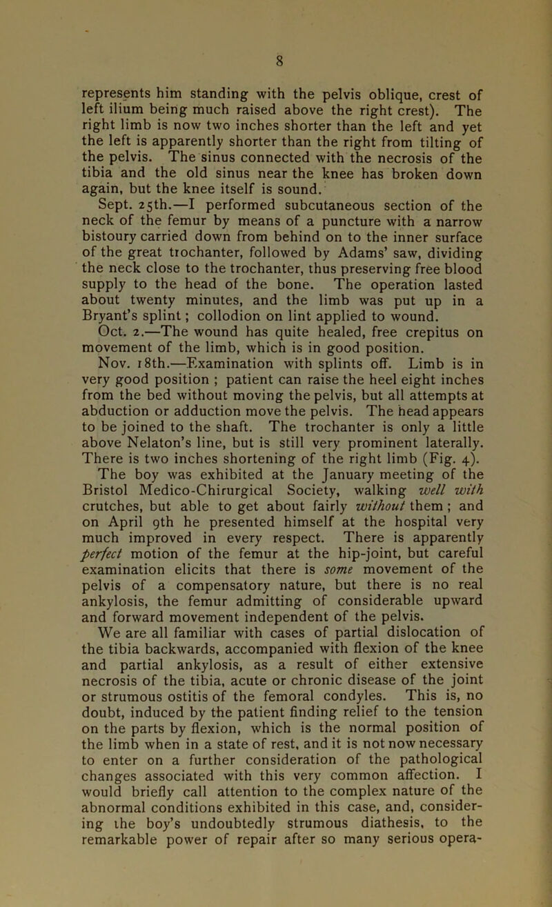 represents him standing with the pelvis oblique, crest of left ilium being much raised above the right crest). The right limb is now two inches shorter than the left and yet the left is apparently shorter than the right from tilting of the pelvis. The sinus connected with the necrosis of the tibia and the old sinus near the knee has broken down again, but the knee itself is sound. Sept. 25th.—I performed subcutaneous section of the neck of the femur by means of a puncture with a narrow bistoury carried down from behind on to the inner surface of the great trochanter, followed by Adams’ saw, dividing the neck close to the trochanter, thus preserving free blood supply to the head of the bone. The operation lasted about twenty minutes, and the limb was put up in a Bryant’s splint; collodion on lint applied to wound. Oct. 2.—The wound has quite healed, free crepitus on movement of the limb, which is in good position. Nov. 18th.—Examination with splints off. Limb is in very good position ; patient can raise the heel eight inches from the bed without moving the pelvis, but all attempts at abduction or adduction move the pelvis. The head appears to be joined to the shaft. The trochanter is only a little above Nelaton’s line, but is still very prominent laterally. There is two inches shortening of the right limb (Fig. 4). The boy was exhibited at the January meeting of the Bristol Medico-Chirurgical Society, walking well with crutches, but able to get about fairly without them ; and on April 9th he presented himself at the hospital very much improved in every respect. There is apparently perfect motion of the femur at the hip-joint, but careful examination elicits that there is some movement of the pelvis of a compensatory nature, but there is no real ankylosis, the femur admitting of considerable upward and forward movement independent of the pelvis. We are all familiar with cases of partial dislocation of the tibia backwards, accompanied with flexion of the knee and partial ankylosis, as a result of either extensive necrosis of the tibia, acute or chronic disease of the joint or strumous ostitis of the femoral condyles. This is, no doubt, induced by the patient finding relief to the tension on the parts by flexion, which is the normal position of the limb when in a state of rest, and it is not now necessary to enter on a further consideration of the pathological changes associated with this very common affection. I would briefly call attention to the complex nature of the abnormal conditions exhibited in this case, and, consider- ing the boy’s undoubtedly strumous diathesis, to the remarkable power of repair after so many serious opera-