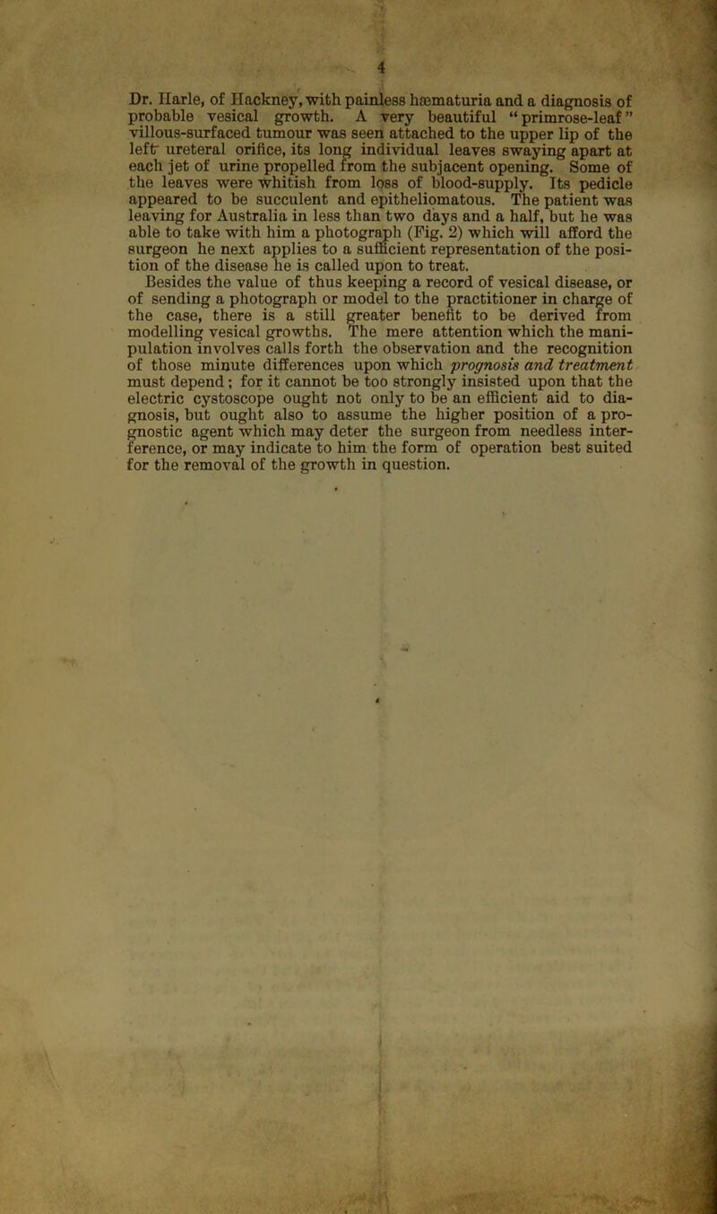 Dr. Ilarle, of Hackney, with painless haematuria and a diagnosis of probable vesical growth. A very beautiful “primrose-leaf” villous-surfaced tumour was seen attached to the upper lip of the left ureteral orifice, its long individual leaves swaying apart at each jet of urine propelled from the subjacent opening. Some of the leaves were whitish from loss of blood-supply. Its pedicle appeared to be succulent and epitheliomatous. The patient was leaving for Australia in less than two days and a half, but he was able to take with him a photogr^h (Fig. 2) which will afford the surgeon he next applies to a sufficient representation of the posi- tion of the disease he is called upon to treat. Besides the value of thus keeping a record of vesical disease, or of sending a photograph or model to the practitioner in charge of the case, there is a still greater benefit to be derived from modelling vesical growths. The mere attention which the mani- pulation involves calls forth the observation and the recognition of those minute differences upon which prognosis and treatment must depend; for it cannot be too strongly insisted upon that the electric cystoscope ought not only to be an efficient aid to dia- gnosis, but ought also to assume the higher position of a pro- raostic agent which may deter the surgeon from needless inter- ference, or may indicate to him the form of operation best suited for the removal of the growth in question.