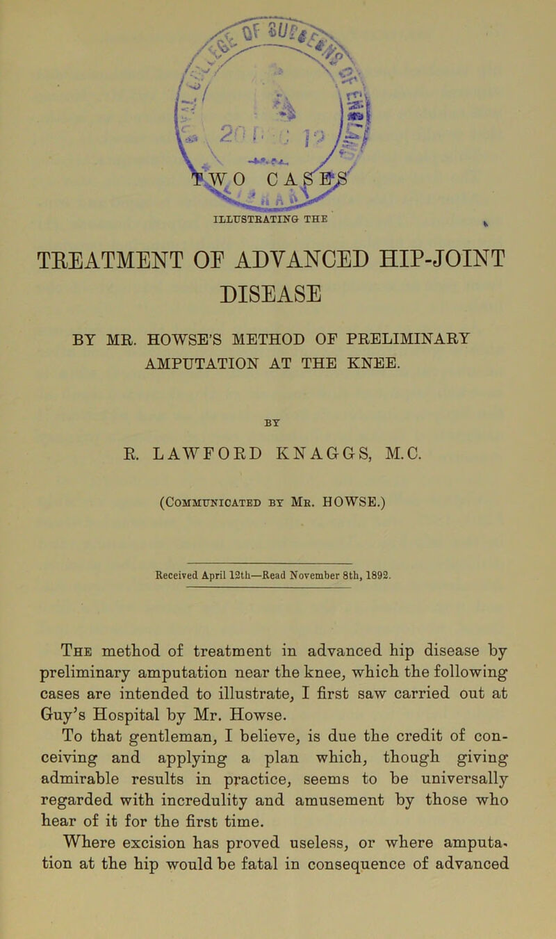 ILLUSTRATING THE TREATMENT OE ADVANCED HIP-JOINT DISEASE BY MR. HOWSE’S METHOD OF PRELIMINARY AMPUTATION AT THE KNEE. BY R. LAWFORD KNAGGS, M.C. (Communicated by Mb. HOWSE.) Received April 12th—Read November 8th, 1892. The method of treatment in advanced hip disease by- preliminary amputation near the knee, which the following cases are intended to illustrate, I first saw carried out at Guy’s Hospital by Mr. Howse. To that gentleman, I believe, is due the credit of con- ceiving and applying a plan which, though giving admirable results in practice, seems to be universally regarded with incredulity and amusement by those who hear of it for the first time. Where excision has proved useless, or where amputa- tion at the hip would be fatal in consequence of advanced