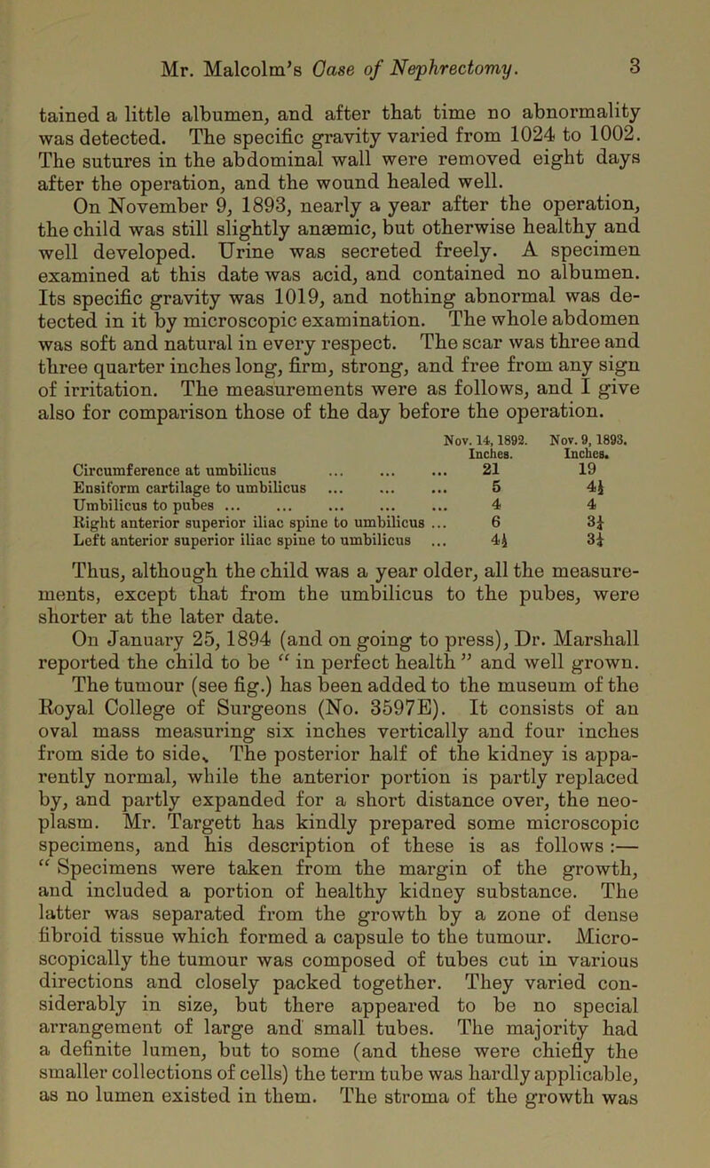 tained a little albumen, and after that time no abnormality was detected. The specific gravity varied from 1024 to 1002. The sutures in the abdominal wall were removed eight days after the operation, and the wound healed well. On November 9, 1893, nearly a year after the operation, the child was still slightly aneemic, but otherwise healthy and well developed. Urine was secreted freely. A specimen examined at this date was acid, and contained no albumen. Its specific gravity was 1019, and nothing abnormal was de- tected in it by microscopic examination. The whole abdomen was soft and natural in every respect. The scar was three and three quarter inches long, firm, strong, and free from any sign of irritation. The measurements were as follows, and I give also for compai’ison those of the day before the operation. Nov. 14,1892. Nov. 9, 1893. Inches. Inches. Circumference at umbilicus ... ... ... 21 19 Ensiform cartilage to umbilicus 5 4£ Umbilicus to pubes ... ... ... ... ... 4 4 Right anterior superior iliac spine to umbilicus ... 6 3£ Left anterior superior iliac spine to umbilicus ... 4^ Thus, although the child was a year older, all the measure- ments, except that from the umbilicus to the pubes, were shorter at the later date. On January 25, 1894 (and on going to press), Dr. Marshall reported the child to be “ in perfect health ” and well grown. The tumour (see fig.) has been added to the museum of the Royal College of Surgeons (No. 3597E). It consists of an oval mass measuring six inches vertically and four inches from side to side% The posterior half of the kidney is appa- rently normal, while the anterior portion is partly replaced by, and partly expanded for a short distance over, the neo- plasm. Mr. Targett has kindly prepared some microscopic specimens, and his description of these is as follows:— “ Specimens were taken from the margin of the growth, and included a portion of healthy kidney substance. The latter was separated from the growth by a zone of dense fibroid tissue which formed a capsule to the tumour. Micro- scopically the tumour was composed of tubes cut in various directions and closely packed together. They varied con- siderably in size, but there appeared to be no special arrangement of large and' small tubes. The majority had a definite lumen, but to some (and these were chiefly the smaller collections of cells) the term tube was hardly applicable, as no lumen existed in them. The stroma of the growth was