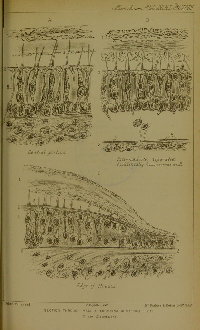 t/otum.', ty/cf XVI.N.S.cify'.Xffllll. A B Edge of ffacula. Intermediate-, separated, accidentally from, osseous wall. Pritchard. <M? Jtf' F*rl*ne &. Erikine LitJ\r* Eimr SECTION THROUGH MACULA ACUSTICA OF SACCULE OF CA I X j3o Diameters.