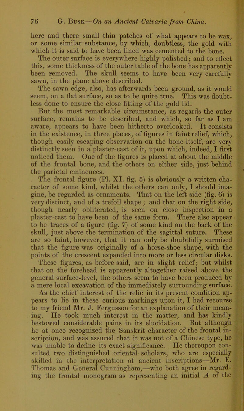 here and there small thin patches of what appears to be wax, or some similar substance, by which, doubtless, the gold with which it is said to have been lined was cemented to the bone. The outer surface is everywhere highly polished; and to effect this, some thickness of the outer table of the bone has apparently been removed. The skull seems to have been very carefully sawn, in the plane above described. The sawn edge, also, has afterwards been ground, as it would seem, on a flat surface, so as to be quite true. This was doubt- less done to ensure the close fitting of the gold lid. But the most remarkable circumstance, as regards the outer surface, remains to be described, and which, so far as I am aware, appears to have been hitherto overlooked. It consists in the existence, in three places, of figures in faint relief, which, though easily escaping observation on the bone itself, are very distinctly seen in a plaster-cast of it, upon which, indeed, I first noticed them. One of the figui’es is placed at about the middle of the frontal bone, and the others on either side, just behind the parietal eminences. The frontal figure (PI. XI. fig. 5) is obviously a written cha- racter of some kind, whilst the others can only, I should ima- gine, be regarded as ornaments. That on the left side (fig. 6) is very distinct, and of a trefoil shape ; and that on the right side, though nearly obliterated, is seen on close inspection in a plaster-cast to have been of the same form. There also appear to be traces of a figure (fig. 7) of some kind on the back of the skull, just above the termination of the sagittal suture. These are so faint, however, that it can only be doubtfully surmised that the figure w'as originally of a horse-shoe shape, with the points of the crescent expanded into more or less circidar disks. These figures, as before said, are in slight relief; but whilst that on the forehead is apparently altogether raised above the general surface-level, the others seem to have been produced by a mere local excavation of the immediately sm’roundiug surface. As the chief interest of the relic in its present condition ap- pears to lie in these curious markings upon it, I had recourse to my friend Mr. J. Fergusson for an explanation of their mean- ing. He took much interest in the matter, and has kindly bestowed considerable pains in its elucidation. But although he at once recognized the Sanskrit character of the frontal in- scription, and was assured that it was not of a Chinese type, he was unable to define its exact significance. He thereupon con- sulted two distinguished oriental scholars, who are especially skilled in the interpretation of ancient inscriptions—Mr. E. Thomas and General Cunningham,—who both agree in regard- ing the frontal monogram as representing an initial A of the