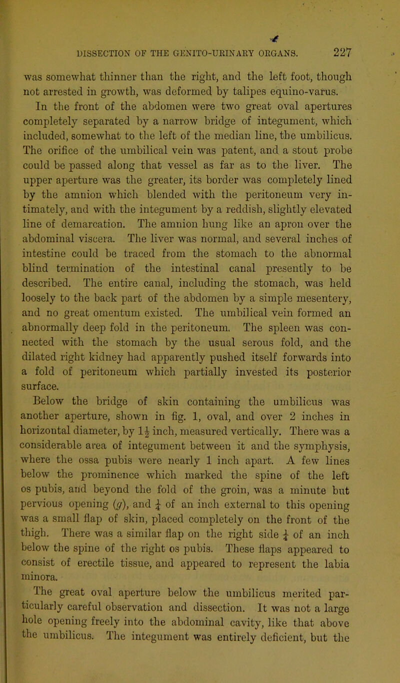 was somewhat thinner than the right, and the left foot, though not arrested in growth, was deformed by talipes equino-varus. In the front of the abdomen were two great oval apertures completely separated by a narrow bridge of integument, which included, somewhat to the left of the median line, the umbilicus. The orifice of the umbilical vein was patent, and a stout probe could be passed along that vessel as far as to the liver. The upper aperture was the greater, its border was completely lined by the amnion which blended with the peritoneum very in- timately, and with the integument by a reddish, slightly elevated line of demarcation. The amnion hung like an apron over the abdominal viscera. The liver was normal, and several inches of intestine could be traced from the stomach to the abnormal blind termination of the intestinal canal presently to be described. The entire canal, including the stomach, was held loosely to the back part of the abdomen by a simple mesentery, and no great omentum existed. The umbilical vein formed an abnormally deep fold in the peritoneum. The spleen was con- nected with the stomach by the usual serous fold, and the dilated right kidney had apparently pushed itself forwards into a fold of peritoneum which partially invested its posterior surface. Below the bridge of skin containing the umbilicus was another aperture, shown in fig. 1, oval, and over 2 inches in horizontal diameter, by inch, measured vertically. There was a considerable area of integument between it and the symphysis, where the ossa pubis were nearly 1 inch apart. A few lines below the prominence which marked the spine of the left os pubis, and beyond the fold of the groin, was a minute but pervious opening (^), and ^ of an inch external to this opening was a small flap of skin, placed completely on the front of the thigh. There was a similar flap on the right side ^ of an inch below the spine of the right os pubis. These flaps appeared to consist of erectile tissue, and appeared to represent the labia minora. The great oval aperture below the umbilicus merited par- ticularly careful observation and dissection. It was not a large hole opening freely into the abdominal cavity, like that above the umbilicus. The integument was entirely deficient, but the