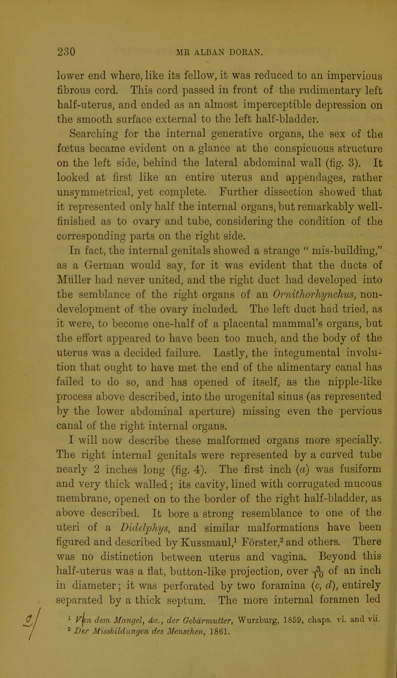 lower end where, like its fellow, it was reduced to an impervious fibrous cord. This cord passed in front of the rudimentary left half-uterus, and ended as an almost imperceptible depression on the smooth surface external to the left half-bladder. Searching for the internal generative organs, the sex of the foetus became evident on a glance at the conspicuous structure on the left side, behind the lateral abdominal wall (fig. 3). It looked at first like an entire uterus and appendages, rather unsymmetrical, yet copiplete. Further dissection showed that it represented only half the internal organs, but remarkably well- finished as to ovary and tube, considering the condition of the corresponding parts on the right side. In fact, the internal genitals showed a strange “ mis-building,” as a German would say, for it was evident that the ducts of IMuller had never united, and the right duct had developed into the semblance of the right organs of an Ornithorhynclius, non- development of the ovary included. The left duct had tried, as it were, to become one-half of a placental mammal’s organs, but the effort appeared to have been too much, and the body of the uterus was a decided failure. Lastly, the integumental involu- tion that ought to have met the end of the alimentary canal has failed to do so, and has opened of itself, as the nipple-lilce process above described, into the urogenital sinus (as represented by the lower abdominal aperture) missing even the pervious canal of the right internal organs. I will now describe these malformed organs more specially. The right internal genitals were represented by a curved tube nearly 2 inches long (fig. 4). The first inch (a) was fusiform and very thick walled; its cavity, lined with corrugated mucous membrane, opened on to the border of the right half-bladder, as above described. It bore a strong resemblance to one of the uteri of a Didelphys, and similar malformations have been figured and described by KussmauV Forster,^ and others. There was no distinction between uterus and vagina. Beyond this half-uterus was a flat, button-like projection, over ^ of an inch in diameter; it was perforated by two foramina (c, d), entirely separated by a thick septum. The more internal foramen led ^ V^n dem Mangel, d-c., der Gehdrvmtter, Wurzburg, 1859, cliaps. vi. and vii. ’ Der Missbildangen des M-enschen, 1861.
