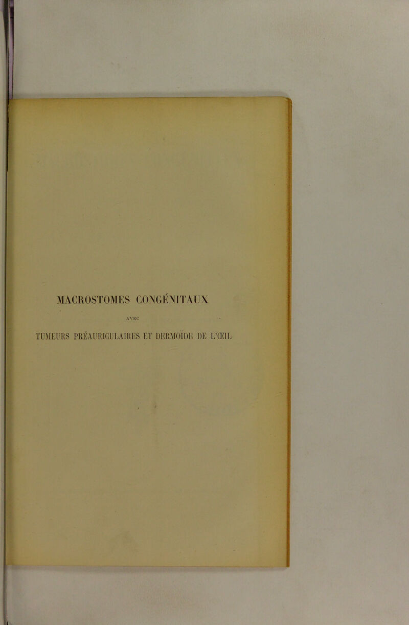 MACROSTOMES CONGENITAUX AVEC TUMEURS PRÉAURICULAIRES ET DERMOIDE DE L’ŒIL