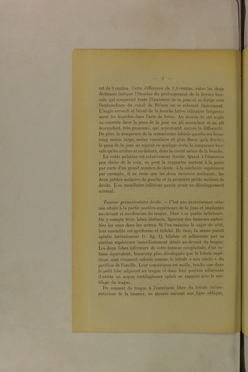 est de 9 centim. Cette différence de 1,5 centim. entre les deux distances indique l’étendue du prolongement de la fissure buc- cale qui comprend toute l’épaisseur de la joue et se dirige vers l’embouchure du canal de Sténon en se relevant légèrement. L’angle arrondi et béant de la bouche laisse échapper fréquem- ment les liquides dans l’acte de boire. Au niveau de cet angle on constate dans la peau de la joue un pli ascendant et un pli descendant, très prononcé, qui accentuent encore la difformité. De plus, la muqueuse de la commissure labiale gauche est beau- coup moins large, moins vasculaire et plus dense qu’à droite : la peau de la joue ne rejoint en quelque sorte la muqueuse buc- cale qu’en arrière et en-dehors, dans la cavité même de la bouche. La voûte palatine est relativement étroite. Quant à l’émission peu claire de la voix, on peut la rapporter surtout à la perte par carie d’un grand nombre de dents : à la mâchoire supérieure par exemple, il ne reste que les deux incisives médianes, les deux petites molaires de gauche et la première petite molaire de droite. L’os maxillaire inférieur paraît avoir un développement normal. Tumeur 'préauriculaire droite. — C’est une excroissance cuta- née située à la partie postéro-supérieure de la joue et implantée au-devant et au-dessous du tragus, libre à sa partie inférieure. On y compte trois lobes distincts, figurant des tumeurs emboi- tées les unes dans les autres. Si l’on examine le sujet de côté, leur ensemble est pyriforme et trilobé. De face, la masse paraît aplatie latéralement (v. fig. 1), bilobée et adhérente par sa portion supérieure immédiatement située au-devant du tragus. Les deux lobes inférieurs de cette tumeur congénitale, d’un vo- lume équivalent, beaucoup plus développés que le lobule supé- rieur, sont vivement colorés comme le lobule « non ourlé » du pavillon de l’oreille. Leur consistance est molle, tandis que dans le petit lobe adjacent au tragus et dans leur portion adhérente il existe un noyau cartilagineux aplati en rapport avec le car- tilage du tragus. Du sommet du tragus à l’extrémité libre du lobule inféro- antérieur de la tumeur, on mesure suivant une ligne oblique,