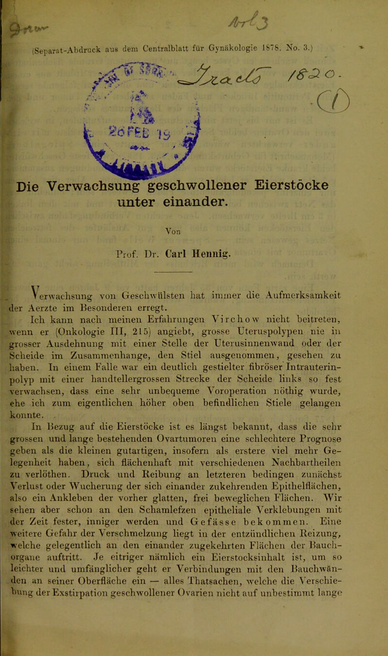 Verwachsung von Geschwülsten hat immer die Aufmerksamkeit der Aerzte im Besonderen erregt. Ich kann nach meinen Erfahrungen Yirchow nicht beitreten, wenn er (Onkologie III, 2L5) angiebt, grosse Uteruspolypen nie in grosser Ausdehnung mit einer Stelle der Uterusinnenwand oder der Scheide im Zusammenhänge, den Stiel ausgenommen, gesehen zu haben. In einem Falle war ein deutlich gestielter fibröser Intrauterin- polyp mit einer handtellergrossen Strecke der Scheide links so fest verwachsen, dass eine sehr unbequeme Voroperation nöthig wurde, ehe ich zum eigentlichen höher oben befindlichen Stiele gelangen konnte. In Bezug auf die Eierstöcke ist es längst bekannt, dass die sein- grossen und lange bestehenden Ovartumoren eine schlechtere Prognose geben als die kleinen gutartigen, insofern als erstere viel mehr Ge- legenheit haben, sich flächenhaft mit verschiedenen Nachbartheilen zu verlöthen. Druck und Reibung an letzteren bedingen zunächst Verlust oder Wucherung der sich einander zukehrenden Epithelflächen, also ein Ankleben der vorher glatten, frei beweglichen Flächen. Wir sehen aber schon an den Schamlefzen epitheliale Verklebungen mit der Zeit fester, inniger werden und Gefässe bekommen. Eine weitere Gefahr der Verschmelzung liegt in der entzündlichen Reizung, welche gelegentlich an den einander zugekehrten Flächen der Bauch- organe auftritt. Je eitriger nämlich ein Eicrstocksinhalt ist, um so leichter und umfänglicher geht er Verbindungen mit den Bauchwän- den an seiner Oberfläche ein — alles Thatsachen, welche die Verschie- bung der Exstirpation geschwollener Ovarien nicht auf unbestimmt lange