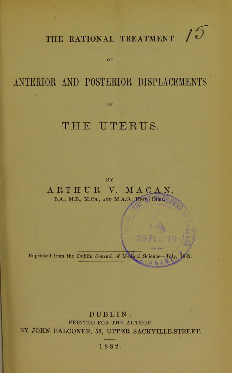 THE RATIONAL TREATMENT ANTERIOR AND POSTERIOR DISPLACEMENTS OF THE UTERUS. BY DUBLIN: PRINTED FOR THE AUTHOR BY JOHN FALCONER, 53, UPPER SACKVILLE-STREET.