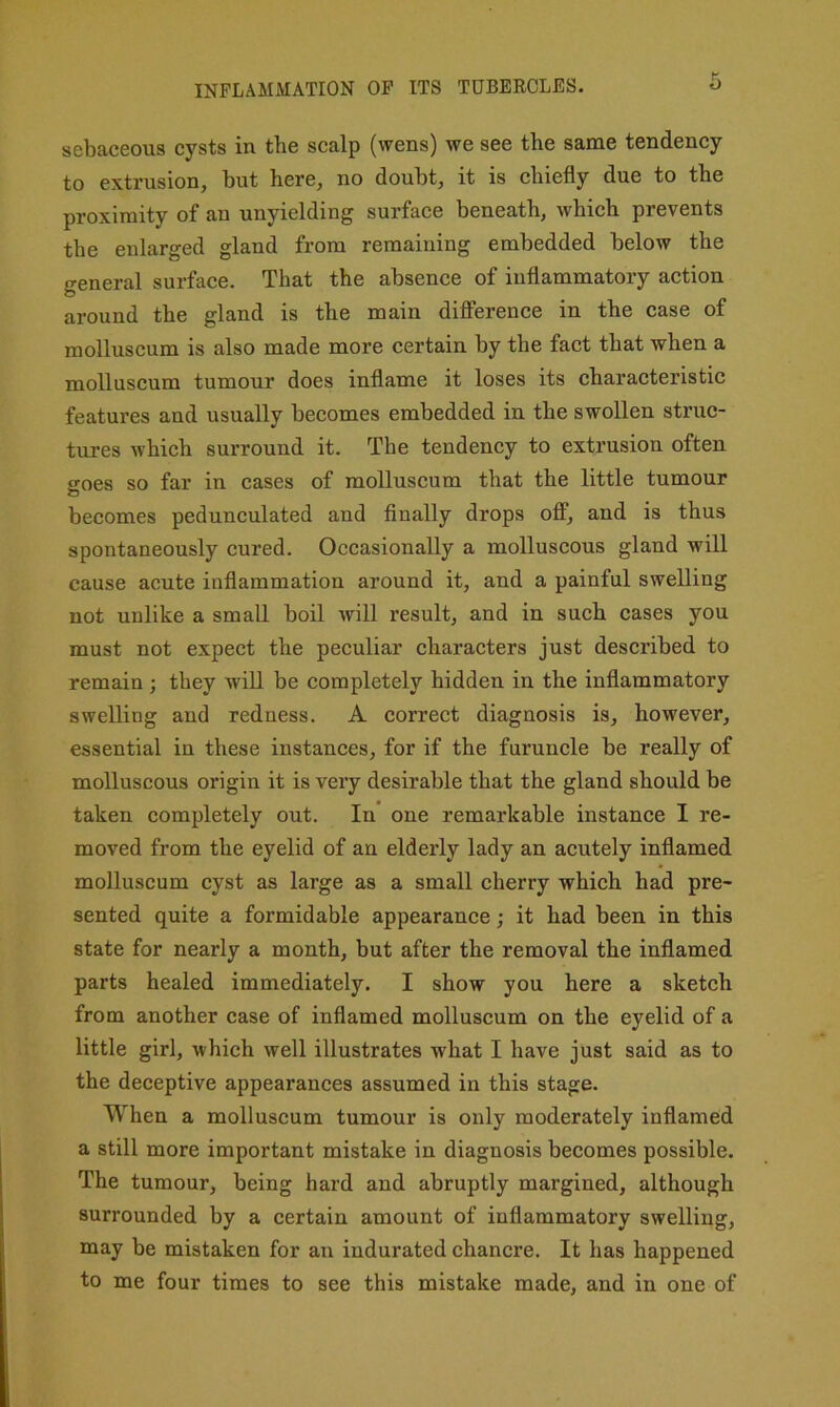 INFLAMMATION OP ITS TUBERCLES. sebaceous cysts in the scalp (wens) we see the same tendency to extrusion, but here, no doubt, it is chiefly due to the proximity of an unyielding surface beneath, which prevents the enlarged gland from remaining embedded below the general surface. That the absence of inflammatory action around the gland is the main difference in the case of molluscum is also made more certain by the fact that when a molluscum tumour does inflame it loses its characteristic features and usually becomes embedded in the swollen struc- tures which surround it. The tendency to extrusion often goes so far in cases of molluscum that the little tumour becomes pedunculated and finally drops off, and is thus spontaneously cured. Occasionally a molluscous gland will cause acute inflammation around it, and a painful swelling not unlike a small boil will result, and in such cases you must not expect the peculiar characters just described to remain ; they wiU be completely hidden in the inflammatory swelling and redness. A correct diagnosis is, however, essential in these instances, for if the furuncle be really of molluscous origin it is very desirable that the gland should be taken completely out. In one remarkable instance I re- moved from the eyelid of an elderly lady an acutely inflamed molluscum cyst as large as a small cherry which had pre- sented quite a formidable appearance; it had been in this state for nearly a month, but after the removal the inflamed parts healed immediately. I show you here a sketch from another case of inflamed molluscum on the eyelid of a little girl, which well illustrates what I have just said as to the deceptive appearances assumed in this stage. When a molluscum tumour is only moderately inflamed a still more important mistake in diagnosis becomes possible. The tumour, being hard and abruptly margined, although surrounded by a certain amount of inflammatory swelling, may be mistaken for an indurated chancre. It has happened to me four times to see this mistake made, and in one of