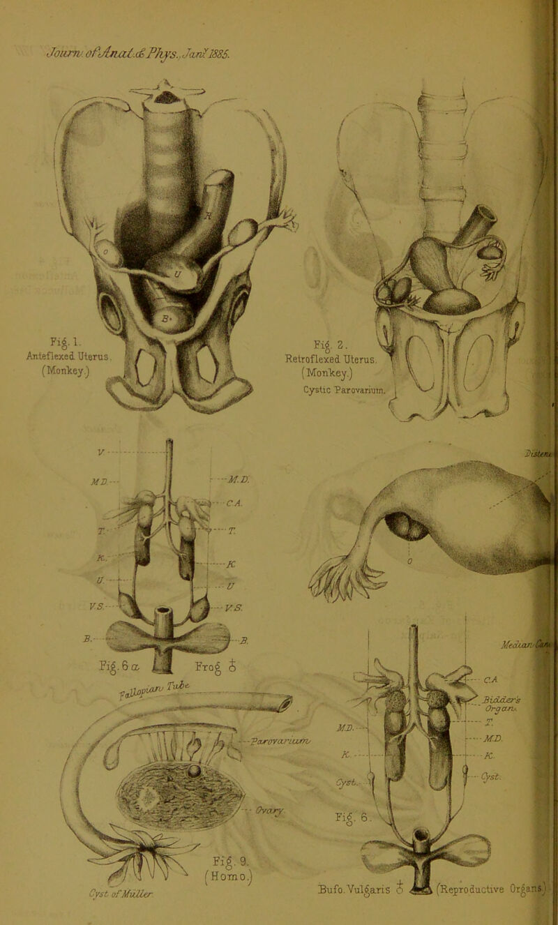 Jourm of'Jjiai.&Phys.,. Jctn?1885. AnteflexecL Uterus (Monkey.) i 2- Relroflexed Uterus (Monkey.) Cystic Parovarium, 'tsltm ftM? ,Oxrv Tuie, / A \l\ ,M —-TouroYanurrv *4 Ovary Cyst ofMiilUr Fig. 9 (Homo) Fi^.6 Bufo. Vulgaris 6 Media/: Guk C.A Bidders Organ* T. MD. K. Cyst. (Reproductive Organs'