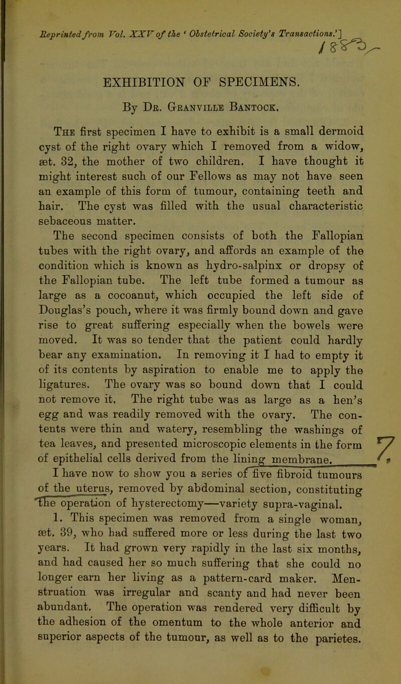 Reprinted from Vol. XXV of the ‘ Obstetrical Society’s Transactions’] EXHIBITION OF SPECIMENS. By Dr. Granville Bantock. The first specimen I have to exhibit is a small dermoid cyst of the right ovary which I removed from a widow, set. 32, the mother of two children. I have thought it might interest such of our Fellows as may not have seen an example of this form of tumour, containing teeth and hair. The cyst was filled with the usual characteristic sebaceous matter. The second specimen consists of both the Fallopian tubes with the right ovary, and affords an example of the condition which is known as hydro-salpinx or dropsy of the Fallopian tube. The left tube formed a tumour as large as a cocoanut, which occupied the left side of Douglas’s pouch, where it was firmly bound down and gave rise to great suffering especially when the bowels were moved. It was so tender that the patient could hardly bear any examination. In removing it I had to empty it of its contents by aspiration to enable me to apply the ligatures. The ovary was so bound down that I could not remove it. The right tube was as large as a hen’s egg and was readily removed with the ovary. The con- tents were thin and watery, resembling the washings of tea leaves, and presented microscopic elements in the form of epithelial cells derived from the lining membrane. I have now to show you a series offive fibroid tumours of the uterus, removed by abdominal section, constituting 'The operation of hysterectomy—variety supra-vaginal. 1. This specimen was removed from a single woman, set. 39, who had suffered more or less during the last two years. It had grown very rapidly in the last six months, and had caused her so much suffering that she could no longer earn her living as a pattern-card maker. Men- struation was irregular and scanty and had never been abundant. The operation was rendered very difficult by the adhesion of the omentum to the whole anterior and superior aspects of the tumour, as well as to the parietes.