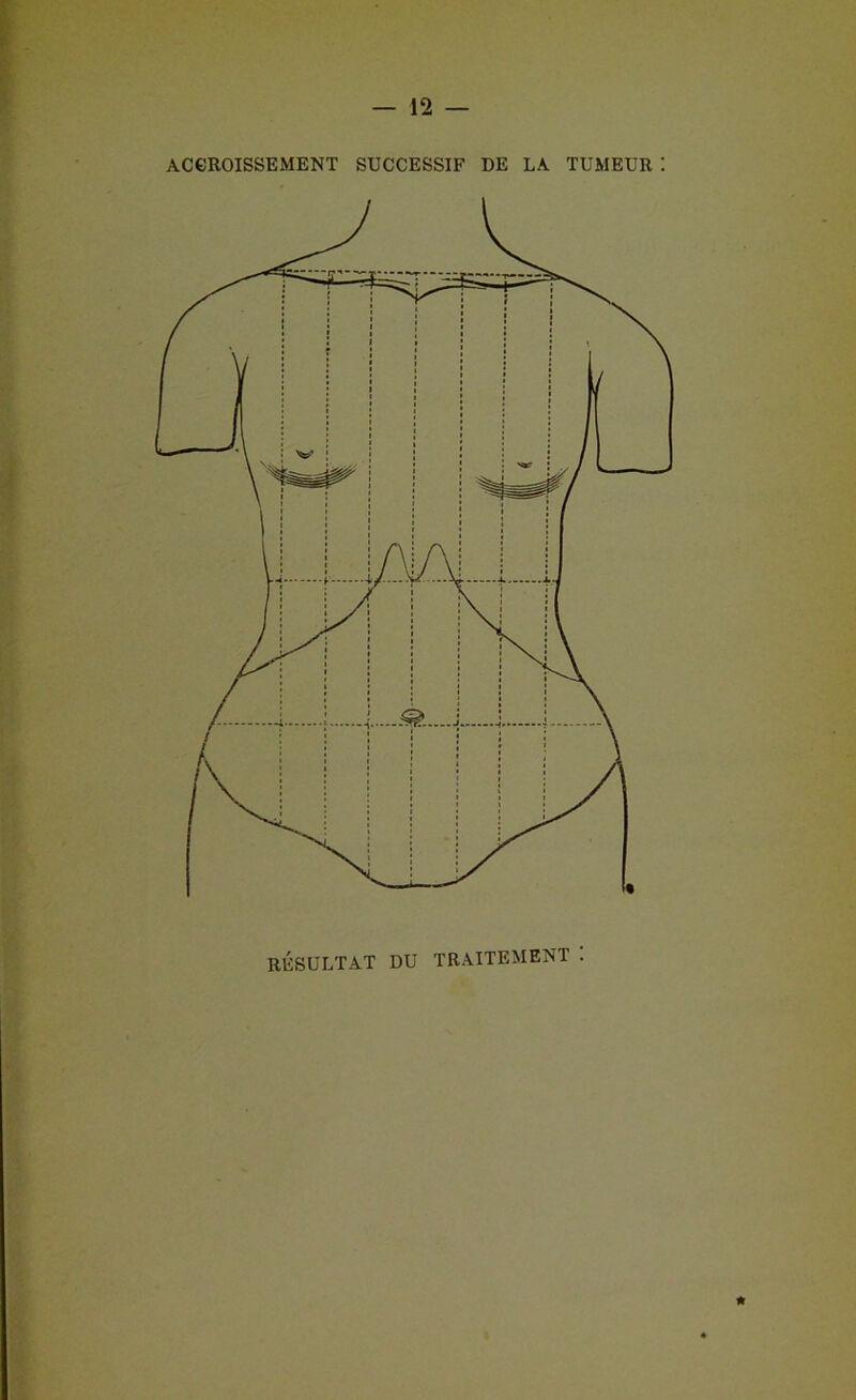 ACCROISSEMENT SUCCESSIF DE LA TUMEUR I RÉSULTAT DU TRAITEMENT . *