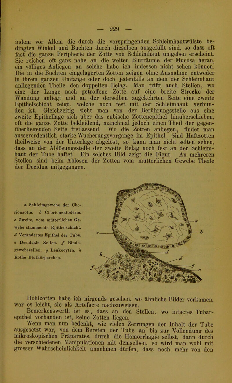 indem vor Allem die durch die vorspringenden Schleimhautwülste be- dingten Winkel und Buchten durch dieselben ausgefüllt sind, so dass oft fast die ganze Peripherie der Zotte von Schleimhaut umgeben erscheint. Sie reichen oft ganz nahe an die weiten Bluträume der Mucosa heran, ein völliges Anliegen an solche habe ich indessen nicht sehen können. Die in die Buchten eingelagerten Zotten zeigen ohne Ausnahme entweder in ihrem ganzen Umfange oder doch jedenfalls an dem der Schleimhaut anliegenden Theile den doppelten Belag. Man trifft auch Stellen, wo eine der Länge nach getroffene Zotte auf eine breite Strecke der Wandung anliegt und an der derselben zugekehrten Seite eine zweite Epithelschicht zeigt, welche noch fest mit der Schleimhaut verbun- den ist. Gleichzeitig sieht man von der Berührungsstelle aus eine zweite Epithellage sich über das cubische Zottenepithel hinüberschieben, oft die ganze Zotte bekleidend, manchmal jedoch einen Theil der gegen- überliegenden Seite freilassend. Wo die Zotten anliegen, findet man ausserordentlich starke Wucherungsvorgänge im Epithel. Sind Haftzotten theilweise von der Unterlage abgelöst, so kann man nicht selten sehen, dass an der Ablösungsstelle der zweite Belag noch fest an der Schleim- haut der Tube haftet. Ein solches Bild zeigt die Figur. An mehreren Stellen sind beim Ablösen der Zotten vom mütterlichen Gewebe Theile der Decidua mitgegangen. a Schleimgewebe der Cho- rionzotte. 6 Chorionektoderm. c Zweite, vom mütterlichen Ge- webe stammende Epithelschicht. d Verändertes Epithel der Tube. e Deciduale Zellen, f Binde- gewebszellen. g Leukocyten. ä Kothe Blutkörperchen. Hohlzotten habe ich nirgends gesehen, wo ähnliche Bilder vorkamen, war es leicht, sie als Artefacte nachzuweisen. Bemerkenswerth ist es, dass an den Stellen, wo intactes Tubar- epithel vorhanden ist, keine Zotten liegen. Wenn man nun bedenkt, wie vielen Zerrungen der Inhalt der Tube ausgesetzt war, von dem Bersten der Tube an bis zur Vollendung des mikroskopischen Präparates, durch die Hämorrhagie selbst, dann durch die verschiedenen Manipulationen mit demselben, so wird man wohl mit grosser Wahrscheinlichkeit annehmen dürfen, dass noch mehr von den