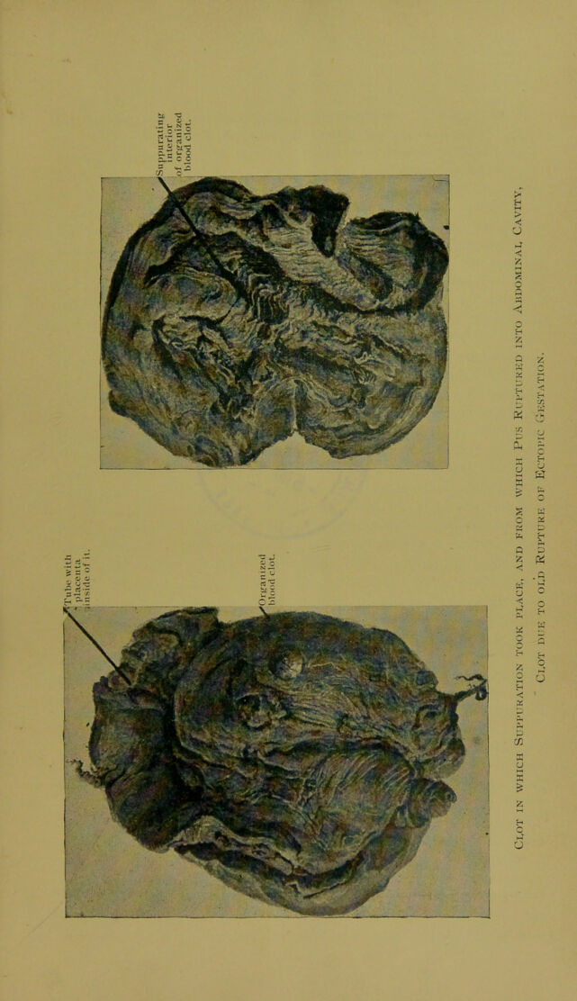 digitised image 3