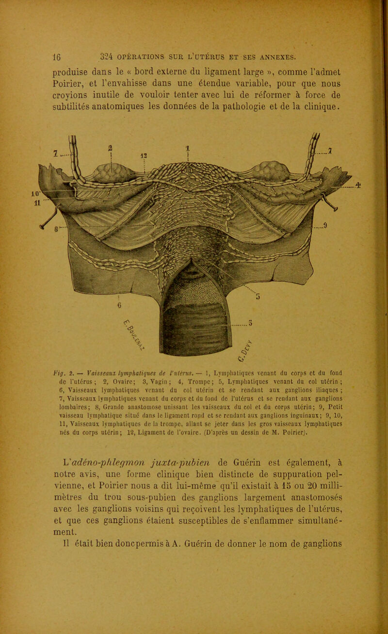 produise dans le « bord externe du ligament large », comme l’admet Poirier, et l’envahisse dans une étendue variable, pour que nous croyions inutile de vouloir tenter avec lui de réformer à force de subtilités anatomiques les données de la pathologie et de la clinique. Fig. 2. — Vaisseau! lymphatiques de l’utérus. — 1, Lymphatiques venant du corps et du fond de l'utérus; 2, Ovaire; 3, Vagin ; 4, Trompe; 5, Lymphatiques venant du col utérin; 6, Vaisseaux lymphatiques venant du col utérin et se rendant aux ganglions iliaques ; 7, Vaisseaux lymphatiques venant du corps et du fond de l’utérus et se rendant aux ganglions lombaires; 8, Grande anastomose unissant les vaisseaux du col et du corps utérin; 9, Petit vaisseau lymphatique situé dans le ligament rond et se rendant aux ganglions inguinaux; 9, 10, 11, Vaisseaux lymphatiques de la trompe, allant se jeter dans les gros vaisseaux lymphatiques nés du corps utérin; 12, Ligament de l’ovaire. (D'après un dessin de M. Poirier). L'adéno-phlec/mon juxta-pubien de Guérin est également, à notre avis, une forme clinique bien distincte de suppuration pel- vienne, et Poirier nous a dit lui-même qu’il existait à 15 ou 20 milli- mètres du trou sous-pubien des ganglions largement anastomosés avec les ganglions voisins qui reçoivent les lymphatiques de l’utérus, et que ces ganglions étaient susceptibles de s’enflammer simultané- ment. Il était bien doncpermis à A. Guérin de donner le nom de ganglions