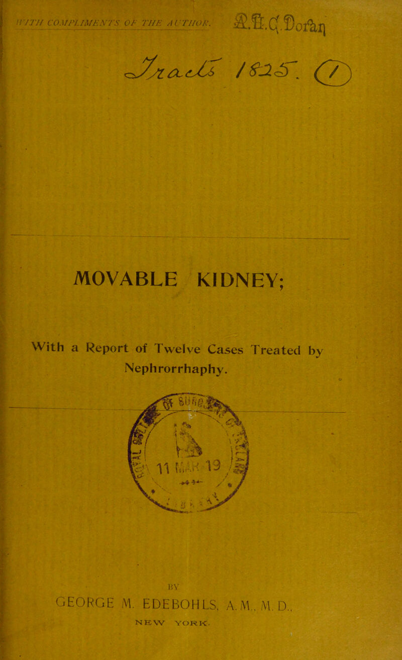 j .. ■ '. ^v.t-r irrrn compliments of the althop. (7^ MOVABLE KIDNEY; With a Report of Twelve Cases Treated by Nephrorrhaphy. <* HV GEORGE M. EDEBOHLS, A.M., M.D.. NEW YORK.