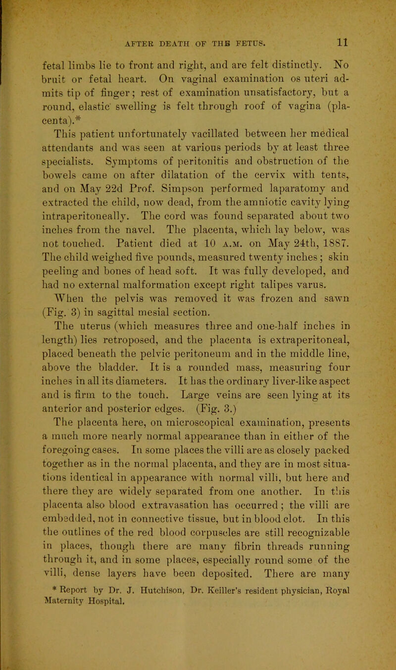fetal limbs lie to front and right, and are felt distinctly. No bruit or fetal heart. On vaginal examination os uteri ad- mits tip of finger; rest of examination unsatisfactory, but a round, elastic' swelling is felt through roof of vagina (pla- centa).* This patient unfortunately vacillated between her medical attendants and was seen at various periods by at least three specialists. Symptoms of peritonitis and obstruction of the bowels came on after dilatation of the cervix with tents, and on May 22d Prof. Simpson performed laparatomy and extracted the child, now dead, from theamniotic cavity lying intraperitoneally. The cord was found separated about two inches from the navel. The placenta, which lay below, was not touched. Patient died at 10 a.m. on May 24th, 1887. The child weighed five pounds, measured twenty inches ; shin peeling and bones of head soft. It was fully developed, and had no external malformation except right talipes varus. When the pelvis was removed it was frozen and sawn (Fig. 3) in sagittal mesial section. The uterus (which measures three and one-half inches in length) lies retroposed, and the placenta is extraperitoneal, placed beneath the pelvic peritoneum and in the middle line, above the bladder. It is a rounded mass, measuring four inches in all its diameters. It has the ordinary liver-like aspect and is firm to the touch. Large veins are seen lying at its anterior and posterior edges. (Fig. 3.) The placenta here, on microscopical examination, presents a much more nearly normal appearance than in either of the foregoing cases. In some places the villi are as closely packed together as in the normal placenta, and they are in most situa- tions identical in appearance with normal villi, but here and there they are widely separated from one another. In this placenta also blood extravasation has occurred ; the villi are embedded, not in connective tissue, but in blood clot. In this the outlines of the red blood corpuscles are still recognizable in places, though there are many fibrin threads running through it, and in some places, especially round some of the villi, dense layers have been deposited. There are many * Report by Dr. J. Hutchison, Dr. Keiller’s resident physician, Royal Maternity Hospital.