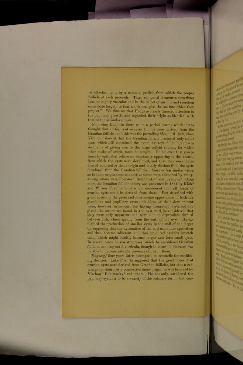 be attached to it by a common pedicle from which the proper pedicle of each proceeds. These elongated structures sometimes become highly vascular and in the defect of an internal secretion contribute largely to that which occupies the sac into which they project.” We thus see that Hodgkin clearly directed attention to the papillary growths and regarded their origin as identical with that of the secondary cysts. Following Hodgkin there came a period during which it was thought that all forms of ovarian tumors were derived from the Graafian follicle; and this was the prevailing idea until 1848, when Virchow2 showed that the Graafian follicle produced only small cysts, which still contained the ovum, hydrops folliculi, and was incapable of giving rise to the large colloid tumors, for which other modes of origin must be sought. He believed that spaces lined by epithelial cells were constantly appearing in the stroma, from which the cysts were developed, and that they were there- fore of connective tissue origin and totally distinct from the cysts developed from the Graafian follicle. More or less similar views as to their origin from connective tissue were advanced by many, among whom were Foerster,3 Rokitansky4 and Frerichs.6 Once more the Graafian follicle theory was presented in 1864 by Klob6 and Wilson Fox,7 both of whom considered that all forms of ovarian cysts could be derived from them. Fox described with great accuracy the gross and microscopic appearances of both the glandular and papillary cysts ; his ideas of their development were, however, erroneous; for having accurately described the gland-like structures found in the cyst wall, he considered that they were only apparent and were due to depressions formed between villi, which sprang from the wall of the cyst. He ex- plained the production of smaller cysts in the wall of the larger by supposing that the extremities of the villi came into apposition and then became adherent, and thus produced cavities beneath them, which might readily become larger and form small cysts. In several cases he saw structures, which he considered Graafian follicles, sending out diverticula, though in none of his cases was he able to demonstrate the presence of ova in them. Mayweg,8 four years later, attempted to reconcile the conflict- ing theories. Like Fox,7 he supposed that the great majority of ovarian cysts were derived from Graafian follicles, but that a cer- tain proportion had a connective tissue origin, as was believed by Virchow,2 Rokitansky4 and others. He not only considered the papillary cystoma to be a variety of the ordinary form ; but con-