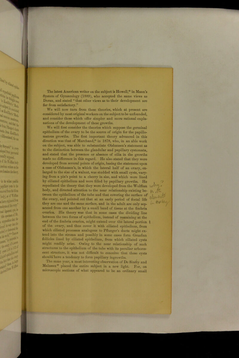 —— The latest American writer on the subject is Howell,20 in Mann’s System of Gynaecology (1889), who accepted the same views as Doran, and stated “ that other views as to their development are far from satisfactory.” We will now turn from these theories, which at present are considered by most original workers on the subject to be unfounded, and consider those which offer simpler and more rational expla- nations of the development of these growths. We will first consider the theories which suppose the germinal epithelium of the ovary to be the source of origin for the papillo- matous growths. The first important theory advanced in this direction was that of Marchand,21 in 1878, who, in an able work on the subject, was able to substantiate Olshausen’s statement as to the distinction between the glandular and papillary cystomata, and stated that the presence or absence of cilia in the growths made no difference in this regard. He also stated that they were developed from several points of origin, basing the statement upon a case of Olshausen’s, in which the lateral half of an ovary, en- larged to the size of a walnut, was studded with small cysts, vary- ing from a pin’s point to a cherry in size, and which were lined by ciliated epithelium and were filled by nanilWv o-rnwt.lis TTp repudiated the theory that they were devc tween the epithelium of the tube and that the ovary, and pointed out that at an eauy penuu ui ±oeuu me they are one and the same surface, and in the adult are only sep- arated from one another by a small band of tissue at the fimbria ovarica. His theory was that in some cases the dividing line between the two forms of epithelium, instead of remaining at the end of the fimbria ovarica, might extend over the lateral portion l of the ovary, and thus cover it with ciliated epithelium, from which ciliated processes analogous to Pflueger’s ducts might ex- tend into the stroma and possibly in some cases form Graafian follicles lined by ciliated epithelium, from which ciliated cysts might readily arise. Owing to the near relationship of such structures to the epithelium of the tube with its peculiar arbores- cent structure, it was not difficult to conceive that these cysts should have a tendency to form papillary ingrowths. The same year, a most interesting observation of De Sinety and Malassez22 placed the entire subject in a new light. For, on microscopic sections of what appeared to be an ordinary small body, and directed attention to the near