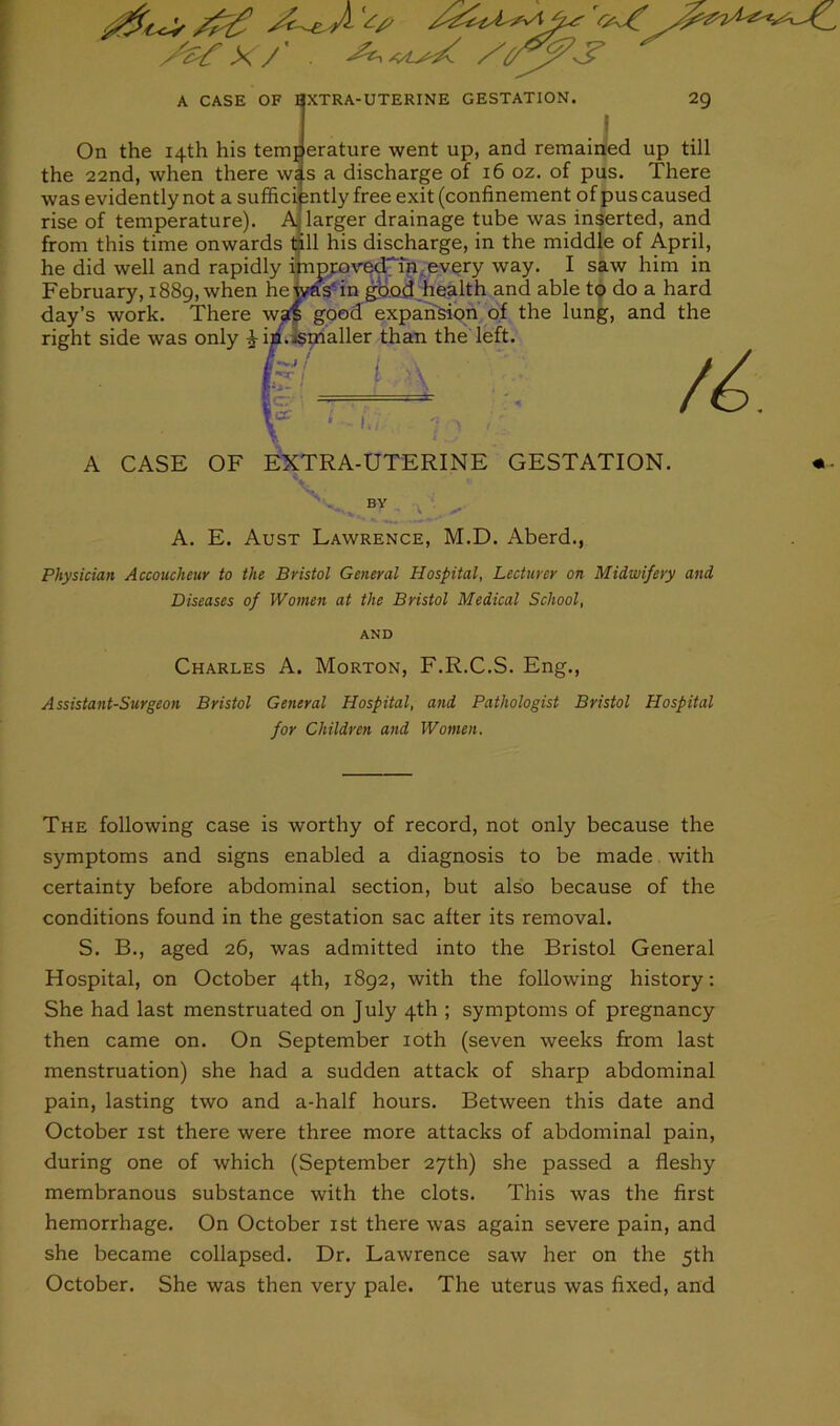 A. E. Aust Lawrence, M.D. Aberd., Physician Accoucheur to the Bristol General Hospital, Lecturer on Midwifery and Diseases of Women at the Bristol Medical School, AND Charles A. Morton, F.R.C.S. Eng., Assistant-Surgeon Bristol General Hospital, and Pathologist Bristol Hospital for Children and Women. The following case is worthy of record, not only because the symptoms and signs enabled a diagnosis to be made with certainty before abdominal section, but also because of the conditions found in the gestation sac after its removal. S. B., aged 26, was admitted into the Bristol General Hospital, on October 4th, 1892, with the following history: She had last menstruated on July 4th ; symptoms of pregnancy then came on. On September 10th (seven weeks from last menstruation) she had a sudden attack of sharp abdominal pain, lasting two and a-half hours. Between this date and October 1st there were three more attacks of abdominal pain, during one of which (September 27th) she passed a fleshy membranous substance with the clots. This was the first hemorrhage. On October 1st there was again severe pain, and she became collapsed. Dr. Lawrence saw her on the 5th October. She was then very pale. The uterus was fixed, and