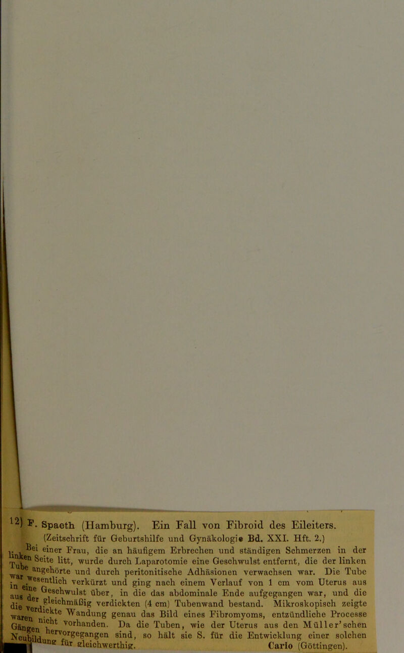 I Spaeth (Hamburg). Ein Fall von Fibroid des Eileiters. j (Zeitschrift fur Geburtshilfe und Gynakologie Bd. XXI. Hft. 2.) V einer Frau, die an haufigem Erbrechen und standigen Schmerzen in der Seite litt, wurde durch Laparotomie eine Geschwulst entfernt, die der linken ■war* an£e^°rte un(l durch peritonitische Adhiisionen verwachsen war. Die Tube in •Wesendich verkiirzt und ging nach einem Verlauf von 1 cm vom Uterus aus aug Geschwulst iiber, in die das abdominale Ende aufgegangen war, und die die ve,j. 'e*chniaBig verdickten (4 cm) Tubenwand bestand. Mikroskopisch zeigte warenr 6 ^an^unE! genau das Bild eines Fibromyoms, entziindliche Processe Ganger'll ^ vor^an^en- Da die Tuben, wie der Uterus aus den Miiller’schen Neuhiu ervorgegangen sind, so halt sie S. fur die Entwicklung einer solchen yBfdun* ft* sleiehwerthig. Carlo (Gottingen).