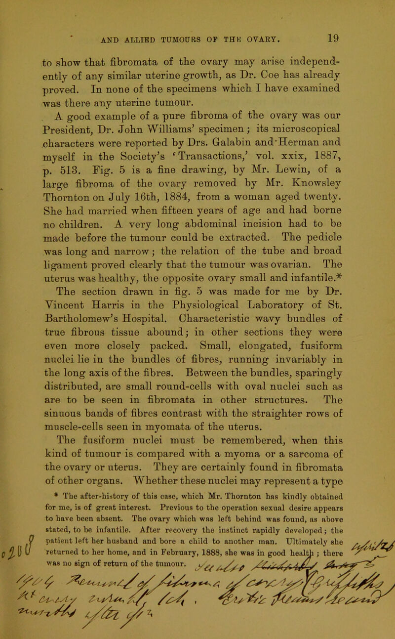 to show that fibromata of the ovary may arise independ- ently of any similar uterine growth, as Dr. Coe has already proved. In none of the specimens which I have examined was there any uterine tumour. A good example of a pure fibroma of the ovary was our President, Dr. John Williams’ specimen; its microscopical characters were reported by Drs. Gralabin and-Herman and myself in the Society’s ‘Transactions,’ vol. xxix, 1887, p. 513. Fig. 5 is a fine drawing, by Mr. Lewin, of a large fibroma of the ovary removed by Mr. Knowsley Thornton on July 16th, 1884, from a woman aged twenty. She had married when fifteen years of age and had borne no children. A very long abdominal incision had to be made before the tumour could be extracted. The pedicle was long and narrow; the relation of the tube and broad ligament proved clearly that the tumour was ovarian. The uterus was healthy, the opposite ovary small and infantile.* The section drawn in fig. 5 was made for me by Dr. Vincent Harris in the Physiological Laboratory of St. Bartholomew’s Hospital. Characteristic wavy bundles of true fibrous tissue abound; in other sections they were even more closely packed. Small, elongated, fusiform nuclei lie in the bundles of fibres, running invariably in the long axis of the fibres. Between the bundles, sparingly distributed, are small round-cells with oval nuclei such as are to be seen in fibromata in other structures. The sinuous bands of fibres contrast with the straighter rows of muscle-cells seen in myomata of the uterus. The fusiform nuclei must be remembered, when this kind of tumour is compared with a myoma or a sarcoma of the ovary or uterus. They are certainly found in fibromata of other organs. Whether these nuclei may represent a type * The after-history of this case, which Mr. Thornton has kindly obtained for me, is of great interest. Previous to the operation sexual desire appears to have been absent. The ovary which was left behind was found, as above stated, to be infantile. After recovery the instinct rapidly developed; the