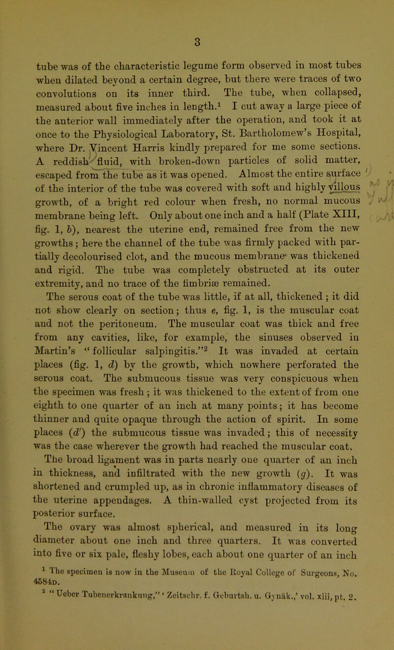 tube was of the characteristic legume form observed in most tubes when dilated beyond a certain degree, but there were traces of two convolutions on its inner third. The tube, when collapsed, measured about five inches iu length.^ I cut away a large piece of the anterior wall immediately after the operation, and took it at once to the Physiological Laboratory, St. Bartholomew’s Hospital, where Dr. Yincent Harris kindly prepared for me some sections. A reddish^'fluid, with broken-down particles of solid matter, escaped from the tube as it was opened. Almost the entire surface y of the interior of the tube was covered with soft and highly villous ^ growth, of a bright red colour when fresh, no normal mucous j membrane being left. Only about one inch and a half (Plate XIII, , Ay fig. 1, 6), nearest the uterine end, remained free from the new growths; here the channel of the tube was firmly packed with par- tially decolourised clot, and the mucous membrane' was thickened and rigid. The tube was completely obstructed at its outer extremity, and no trace of the fimbrise remained. The serous coat of the tube was little, if at all, thickened ; it did not show clearly on section; thus e, fig. 1, is the muscular coat and not the peritoneum. The muscular coat was thick and free from any cavities, like, for example, the sinuses observed iu Martin’s “ follicular salpingitis.”^ It was invaded at certain places (fig. 1, d) by the growth, which nowhere perforated the serous coat. The submucous tissue was very conspicuous when the specimen was fresh; it was thickened to the extent of from one eighth to one quarter of an inch at many points; it has become thinner and quite opaque through the action of spirit. In some places {d') the submucous tissue was invaded; this of necessity was the case wherever the growth had reached the muscular coat. The broad ligament was in parts nearly one quarter of an inch in thickness, and infiltrated with the new growth {g). It was shortened and crumpled up, as in chronic inflammatory diseases of the uterine appendages. A thin-walled cyst projected from its posterior surface. The ovary was almost spherical, and measured in its long diameter about one inch and three quarters. It was converted into five or six pale, fleshy lobes, each about one quarter of an inch ^ The specimen is now in the Museum of the Royal College of Surgeons, No. 45840. *  Ueber Tubcnerkrankung,” ‘ Zeitschr. f. Gcburtsh. u. Gyniik.,’ vol. xiii, pt. 2.