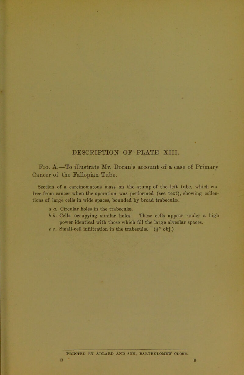 DESCRIPTION OF PLATE XIII. Fig. A.—To illustrate Mr. Doran’s account of a case of Primary Cancer of the Fallopian Tube. Section of a carcinomatous mass on the stump of the left tube, which wa free from cancer when the operation was performed (see text), showing collec- tions of large cells in wide spaces, bounded by broad trabeculae. a a. Circular holes in the trabeculae. I b. Cells occupying similar holes. These cells appear under a high power identical with those which fill the large alveolar spaces. c c. Small-cell infiltration in the trabeculae. (4 obj.) PRINTED BY ADLARD AND SON, BARTHOLOMEW CLOSE. n ' B