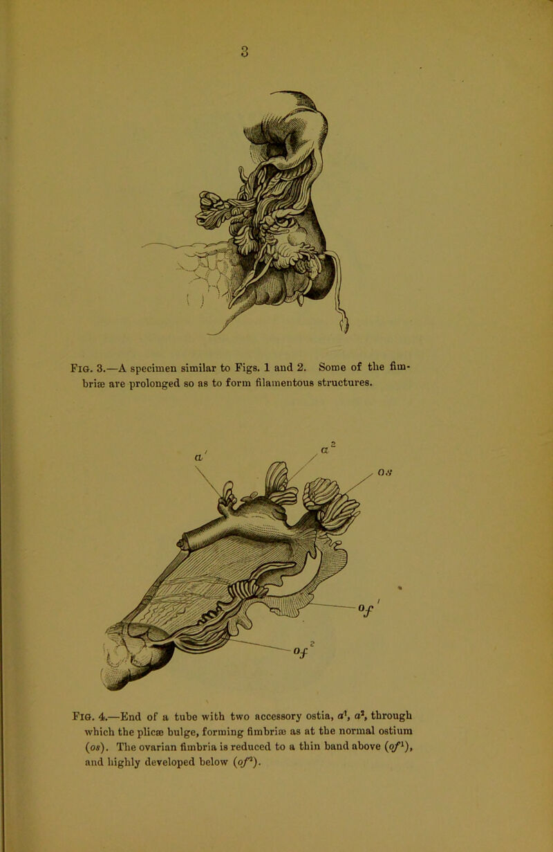 Fig. 3.—A specimen similar to Figs. 1 and 2. Some of the fitn briffi are prolonged so as to form filamentous structures. Fig. 4.—End of a tube with two accessory ostia, a1, a1, through which the plicae bulge, forming fimbria: as at the normal ostium (os). The ovarian fimbria is reduced to a thin band above (of1), and highly developed below (of1).