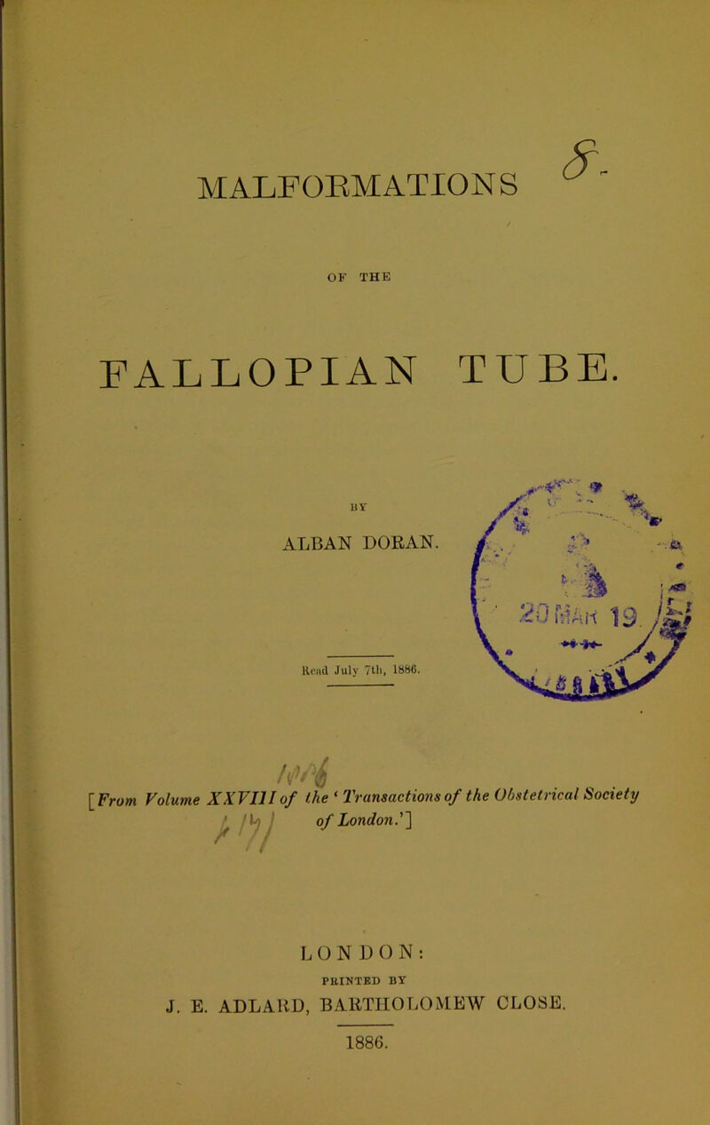 MALFORMATION S OF THE FALLOPIAN TUBE. [From Volume XXVIII of the ‘ Transactions of London.’] of the Obstetrical Society LONDON: PRINTED BY J. E. ADLARD, BARTHOLOMEW CLOSE. 1886.