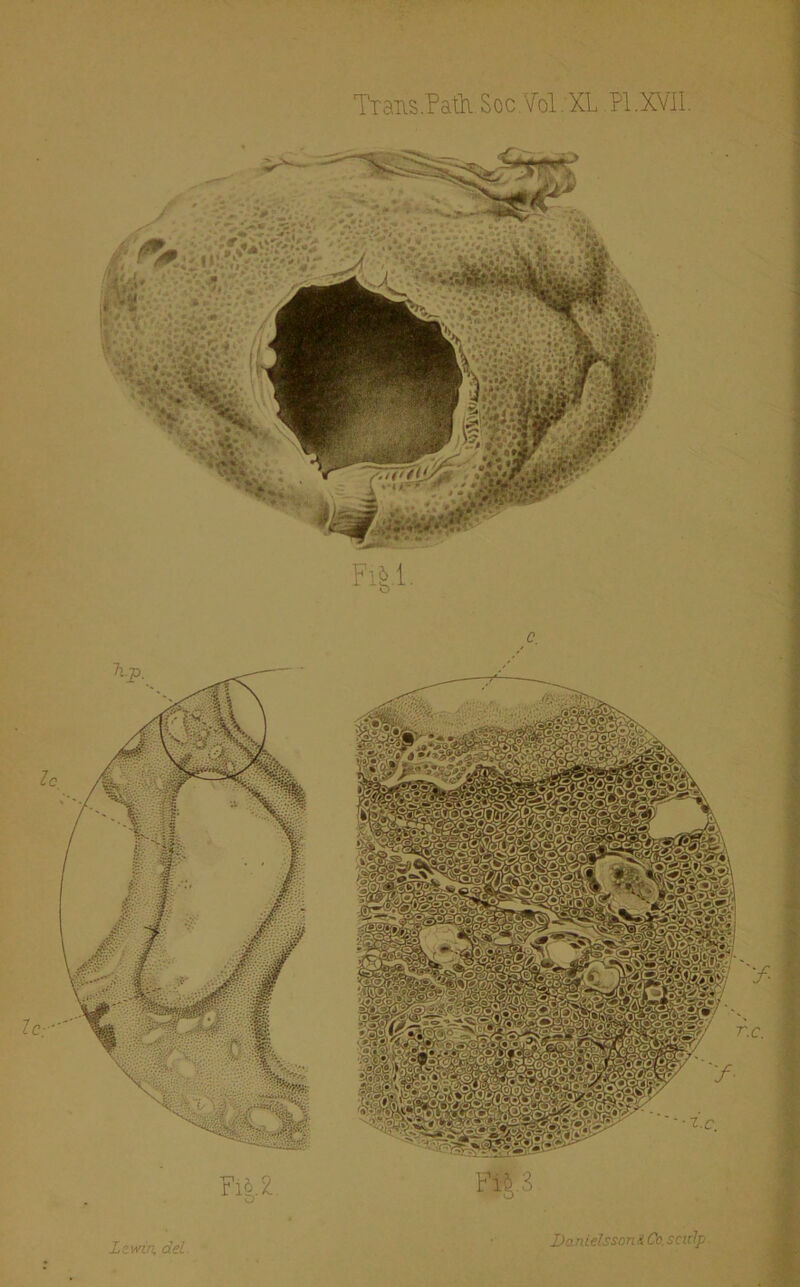 TTaus.Patii.Soc.V’ol.XL,PI.XVII.