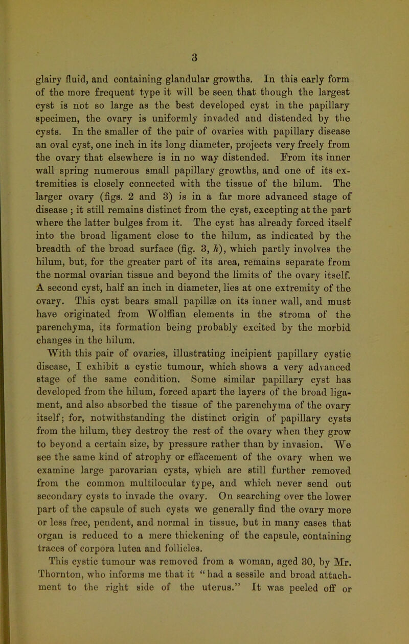 glairy fluid, and containing glandular growths. In this early form of the more frequent type it will be seen that though the largest cyst is not so large as the best developed cyst in the papillary specimen, the ovary is uniformly invaded and distended by the cysts. In the smaller of the pair of ovaries with papillary disease an oval cyst, one inch in its long diameter, projects very freely from the ovary that elsewhere is in no way distended. Trom its inner wall spring numerous small papillary growths, and one of its ex- tremities is closely connected with the tissue of the hilum. The larger ovary (figs. 2 and 3) is in a far more advanced stage of disease ; it still remains distinct from the cyst, excepting at the part where the latter bulges from it. The cyst has already forced itself into the broad ligament close to the hilum, as indicated by the breadth of the broad surface (fig. 3, Ti), which partly involves the hilum, but, for the greater part of its area, remains separate from the normal ovarian tissue and beyond the limits of the ovary itself. A second cyst, half an inch in diameter, lies at one extremity of the ovary. This cyst bears small papillae on its inner wall, and must have originated from Wolffian elements in the stroma of the parenchyma, its formation being probably excited by the morbid changes in the hilum. With this pair of ovaries, illustrating incipient papillary cystic disease, I exhibit a cystic tumour, which shows a very advanced stage of the same condition. Some similar papillary cyst has developed from the hilum, forced apart the layers of the broad liga- ment, and also absorbed the tissue of the parenchyma of the ovary itself; for, notwithstanding the distinct origin of papillary cysts from the hilum, they destroy the rest of the ovary when they grow to beyond a certain size, by pressure rather than by invasion. We see the same kind of atrophy or eflacement of the ovary when we examine large parovarian cysts, vvhich are still further removed from the common multilocular type, and which never send out secondary cysts to invade the ovary. On searching over the lower part of the capsule of such cysts we generally find the ovary more or less free, pendent, and normal in tissue, but in many cases that organ is reduced to a mere thickening of the capsule, containing traces of corpora lutea and follicles. This cystic tumour was removed from a woman, aged 30, by Mr. Thornton, who informs me that it “ had a sessile and broad attach- ment to the right side of the uterus.” It was peeled off or