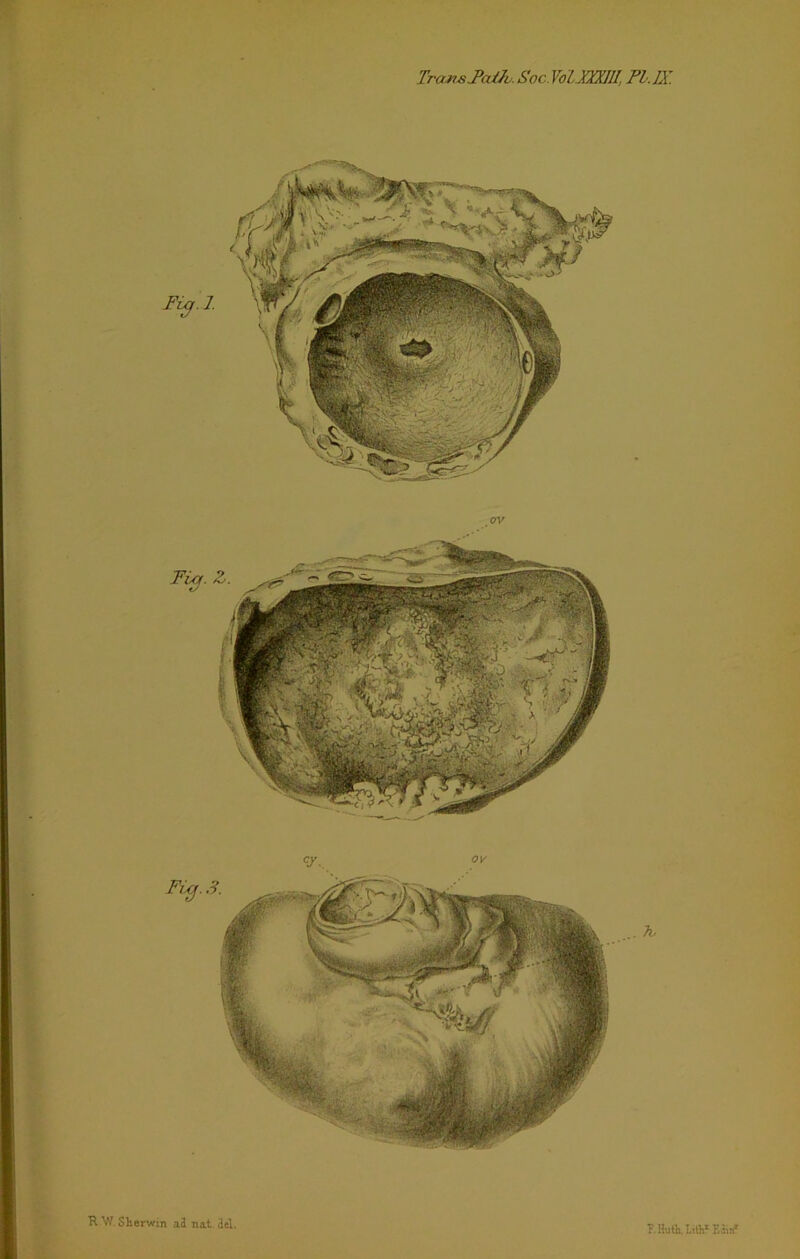 Treat*.Patio. Soc. VoUXXIII, PI. IX. R W Sherwin ad nat del. ?. Huth, Lithx Edin*