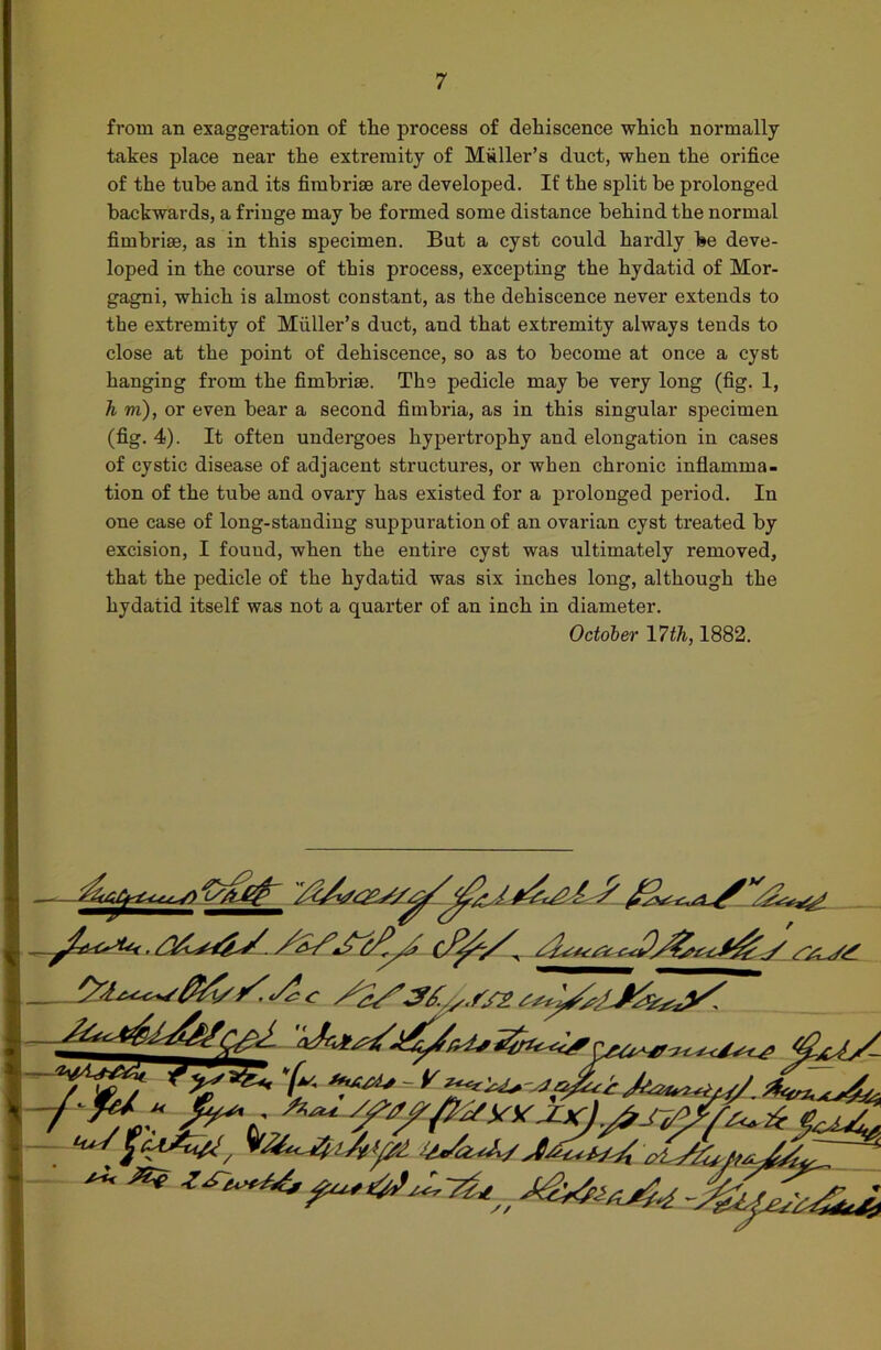 from an exaggeration of the process of dehiscence which normally takes place near the extremity of Muller’s duct, when the orifice of the tube and its fimbrise are developed. If the split be prolonged backwards, a fringe may be formed some distance behind the normal fimbrise, as in this specimen. But a cyst could hardly be deve- loped in the course of this process, excepting the hydatid of Mor- gagni, which is almost constant, as the dehiscence never extends to the extremity of Muller’s duct, and that extremity always tends to close at the point of dehiscence, so as to become at once a cyst hanging from the fimbrise. The pedicle may be very long (fig. 1, h m), or even bear a second fimbria, as in this singular specimen (fig. 4). It often undergoes hypertrophy and elongation in cases of cystic disease of adjacent structures, or when chronic inflamma- tion of the tube and ovary has existed for a prolonged period. In one case of long-standing suppuration of an ovarian cyst treated by excision, I found, when the entire cyst was ultimately removed, that the pedicle of the hydatid was six inches long, although the hydatid itself was not a quainter of an inch in diameter. October 17th, 1882. —dsn, ^V p - „