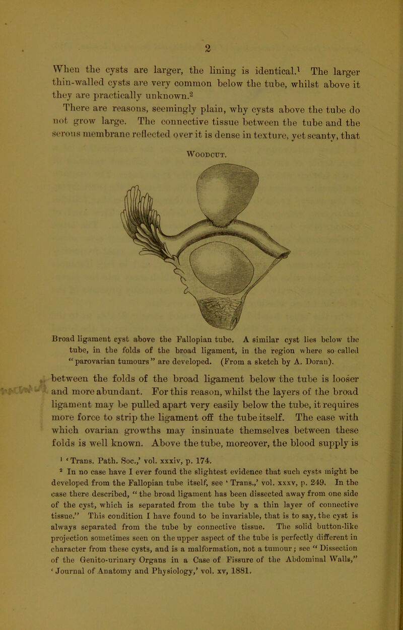When the cysts are larger, the lining is identical.1 The larger thin-walled cysts are very common below the tube, whilst above it they are practically unknown.2 There are reasons, seemingly plain, why cysts above the tube do not grow large. The connective tissue between tbe tube and the serous membrane reflected over it is dense in texture, yet scanty, that Woodcut. Broad ligament cyst above the Fallopian tube. A similar cyst lies below tbe tube, in the folds of the broad ligament, in the region where so-called “parovarian tumours” are developed. (From a sketch by A. Doran). between the folds of the broad ligament below the tube is looser and more abundant. For this reason, whilst the layers of the broad ligament may be pulled apart very easily below the tube, it requires more force to strip the ligament off the tube itself. The ease with which ovarian growths may insinuate themselves between these folds is well known. Above the tube, moreover, the blood supply is 1 ‘Trans. Path. Soc.,’ vol. xxxiv, p. 174. 2 In no case have I ever found the slightest evidence that such cysts might be developed from the Fallopian tube itself, see ‘ Trans.,’ vol. xxxv, p. 249. In the case there described, “ the broad ligament has been dissected away from one side of the cyst, which is separated from the tube by a thin layer of connective tissue.” This condition I have found to be invariable, that is to say, the cyst is always separated from the tube by connective tissue. The solid button-like projection sometimes seen on the upper aspect of the tube is perfectly different in character from these cysts, and is a malformation, not a tumour; see “ Dissection of the Genito-urinary Organs in a Case of Fissure of the Abdominal Walls,” ‘ Journal of Anatomy and Physiology,’ vol. xv, 1881.