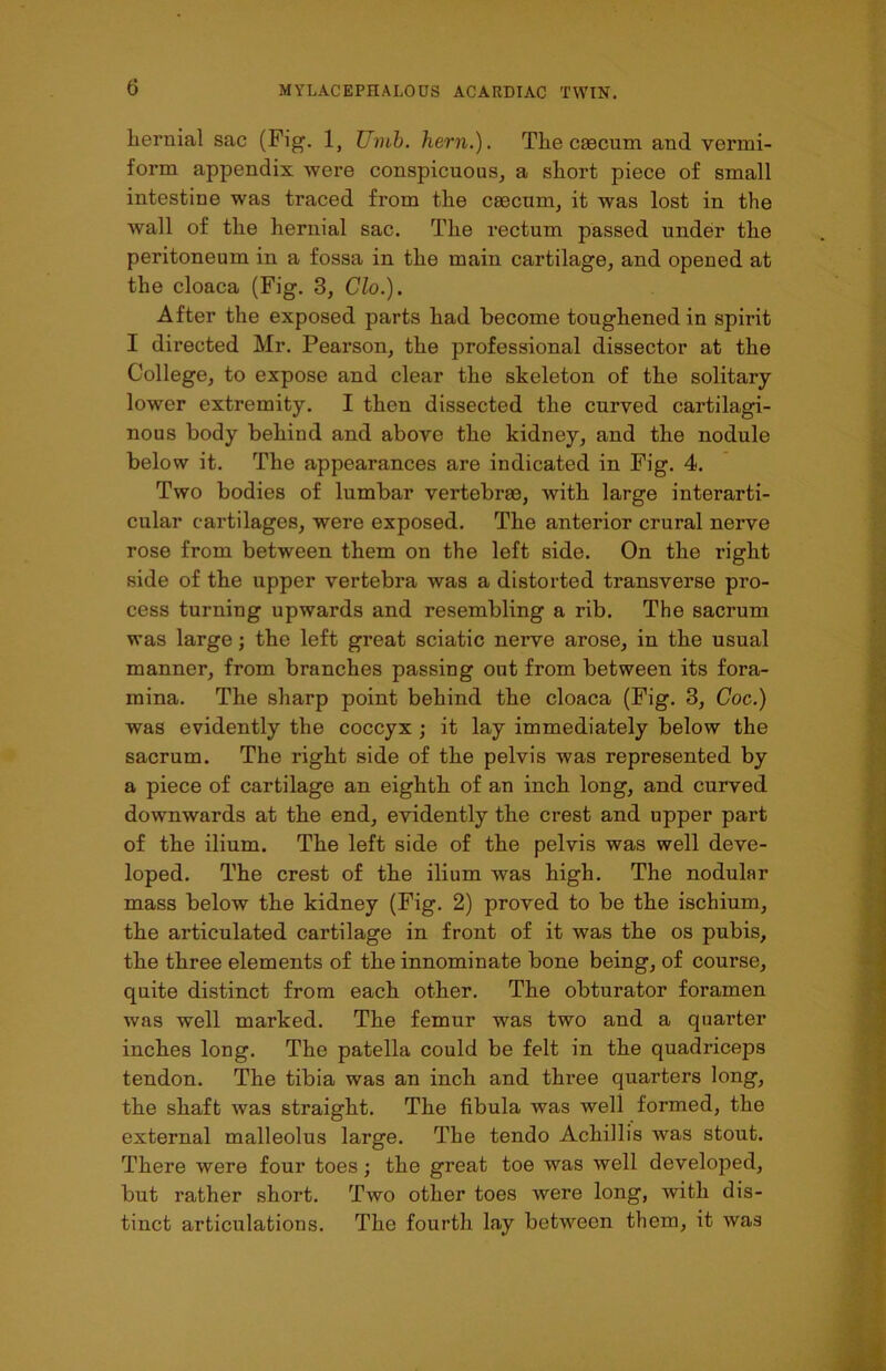 <3 hernial sac (Fig. 1} Uinb. hern.). The caecum and vermi- form appendix were conspicuous, a short piece of small intestine was traced from the caecum, it was lost in the wall of the hernial sac. The rectum passed under the peritoneum in a fossa in the main cartilage, and opened at the cloaca (Fig. 3, Clo.). After the exposed parts had become toughened in spirit I directed Mr. Pearson, the professional dissector at the College, to expose and clear the skeleton of the solitary lower extremity. I then dissected the curved cartilagi- nous body behind and above the kidney, and the nodule below it. The appearances are indicated in Fig. 4. Two bodies of lumbar vertebrae, Avith large interarti- cular cartilages, were exposed. The anterior crural nerve rose from between them on the left side. On the right side of the upper vertebra was a distorted transverse pro- cess turning upwards and resembling a rib. The sacrum was large; the left great sciatic nerve arose, in the usual manner, from branches passing out from between its fora- mina. The sharp point behind the cloaca (Fig. 3, Coc.) was evidently the coccyx ; it lay immediately below the sacrum. The right side of the pelvis Avas represented by a piece of cartilage an eighth of an inch long, and curved downwards at the end, evidently the crest and upper part of the ilium. The left side of the pelvis was well deve- loped. The crest of the ilium was high. The nodular mass below the kidney (Fig. 2) proved to be the ischium, the articulated cartilage in front of it was the os pubis, the three elements of the innominate bone being, of course, quite distinct from each other. The obturator foramen was well marked. The femur was two and a quarter inches long. The patella could be felt in the quadricejDS tendon. The tibia was an inch and three quarters long, the shaft Avas straight. The fibula was well formed, the external malleolus large. The tendo Achillis Avas stout. There were four toes; the great toe was Avell developed, but rather short. Two other toes were long, Avith dis- tinct articulations. The fourth lay betAveen them, it Avas