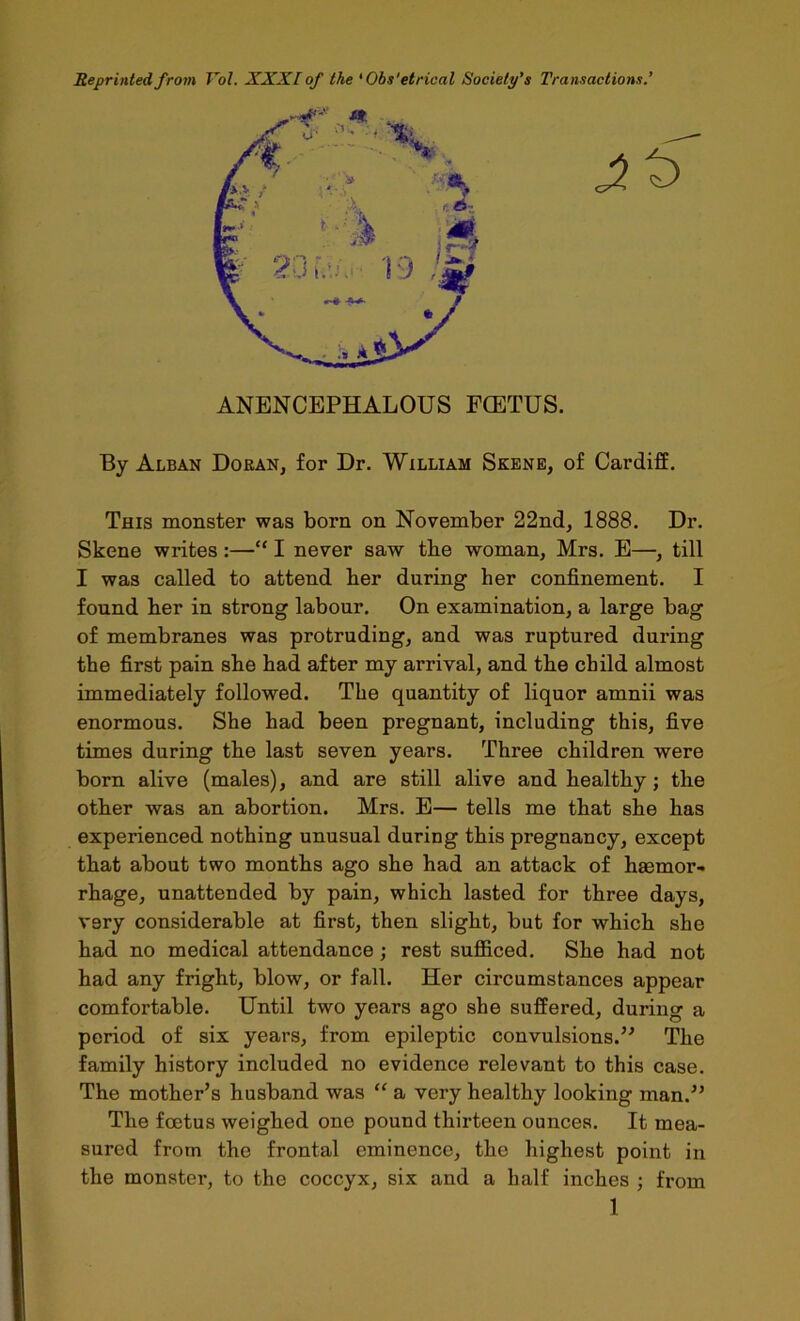 Reprinted from Vol. XXXI of the ‘Obs'etrical Society's Transactions.’ ANENCEPHALOUS FCETUS. By Alban Doean, for Dr. William Skene, of Cardiff. This monster was born on November 22nd, 1888. Dr. Skene writes :—“ I never saw tbe woman, Mrs. E—, till I was called to attend ber during her confinement. I found ber in strong labour. On examination, a large bag of membranes was protruding, and was ruptured during tbe first pain sbe bad after my arrival, and tbe child almost immediately followed. The quantity of liquor amnii was enormous. She had been pregnant, including this, five times during tbe last seven years. Three children were born alive (males), and are still alive and healthy; tbe other was an abortion. Mrs. E— tells me that sbe has experienced nothing unusual during this pregnancy, except that about two months ago sbe had an attack of bsemor- rbage, unattended by pain, which lasted for three days, very considerable at first, then slight, but for which she had no medical attendance; rest sufficed. She had not had any fright, blow, or fall. Her circumstances appear comfortable. Until two years ago she suffered, during a period of six years, from epileptic convulsions.’^ The family history included no evidence relevant to this case. The mother’s husband was “ a very healthy looking man.” The foetus weighed one pound thirteen ounces. It mea- sured from the frontal eminence, the highest point in the monstei', to the coccyx, six and a half inches ; from