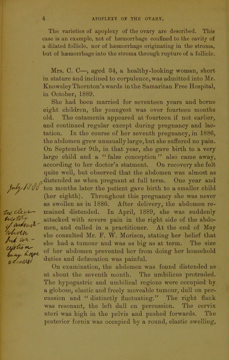 The varieties of apoplexy of the ovary are described. This case is an example, not of haemorrhage confined to the cavity of a dilated follicle, nor of haemorrhage originating in the stroma, but of haemorrhage into the stroma through rupture of a follicle. Mrs. C. C—, aged 34, a healthy-looking woman, short in stature and inclined to corpulence, was admitted into Mr. Knowsley Thornton’s wards in the Samaritan Free Hospital, in October, 1889. She had been married for seventeen years and borne eight children, the youngest was over fourteen months old. The catamenia appeared at •fourteen if not earlier, and continued regular except during pregnancy and lac- tation. In the course of her seventh pregnancy, in 1886, the abdomen grew unusually large, but she suffered no pain. On September 9th, in that year, she gave birth to a very large child and a “ false conception ” also came away, according to her doctor’s statment. On recovery she felt quite well, but observed that the abdomen was almost as distended as when pregnant at full term. One year and ten months later the patient gave birth to a smaller child (her eighth). Throughout this pregnancy she was never as swollen as in 1886. After delivery, the abdomen re- mained distended. In April, 1889, she was suddenly attacked with severe pain in the right side of the abdo- men, and called in a practitioner. At the end of May she consulted Mr. F. W. Morison, stating her belief that she had a tumour and was as big as at term. The size °f ^ier abdomen prevented her from doing her household duties and defaecation was painful. On examination, the abdomen was found distended as at about the seventh month. The umbilicus protruded. The hypogastric and umbilical regions were occupied by a globose, elastic and freely moveable tumour, dull on per- cussion and “ distinctly fluctuating.” The right flank was resonant, the left dull on percussion. The cervix uteri was high in the pelvis and pushed forwards. The posterior fornix was occupied by a round, elastic swelling, f\ ^