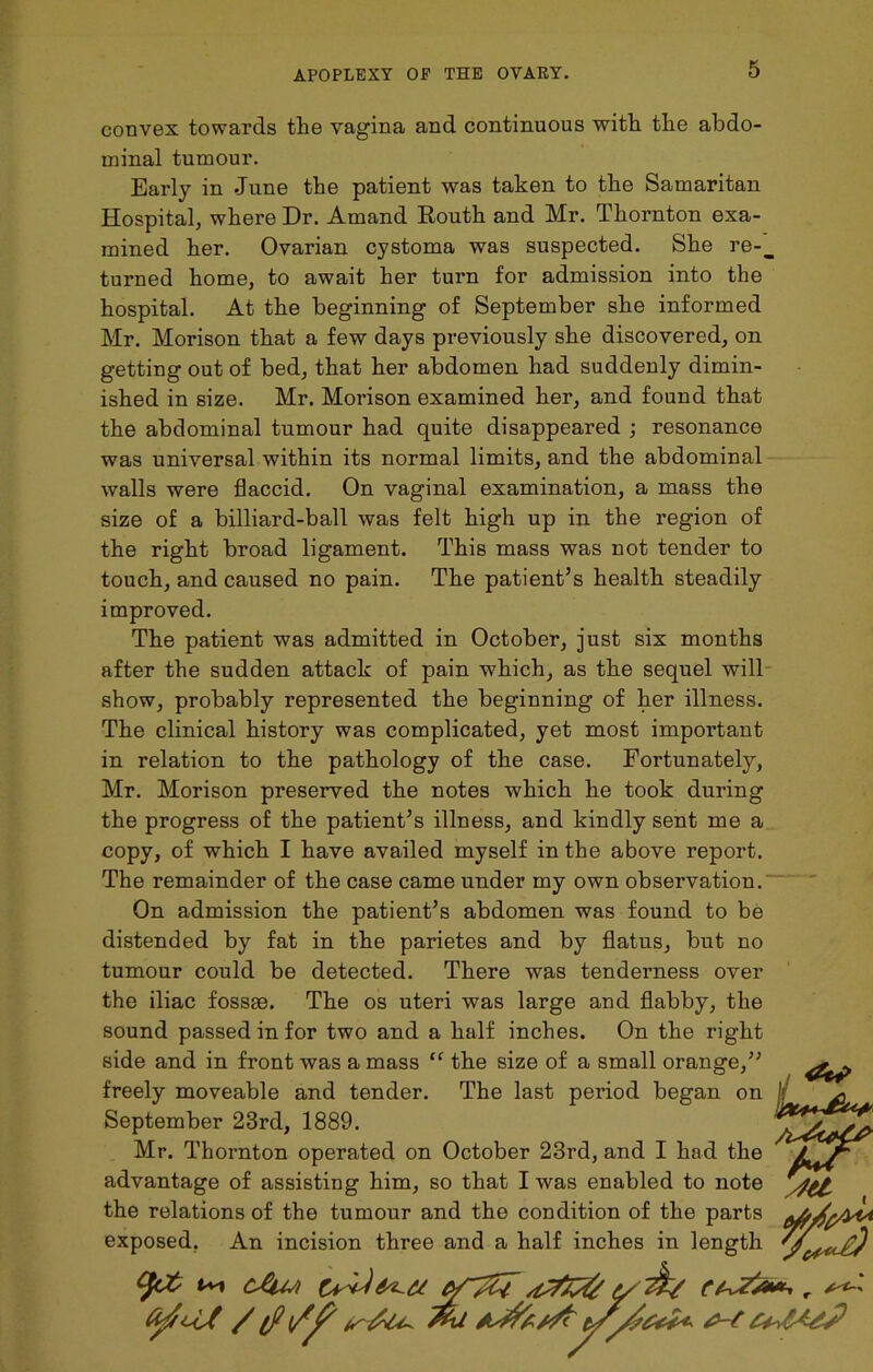 convex towards the vagina and continuous with the abdo- minal tumour. Early in June the patient was taken to the Samaritan Hospital, where Dr. Amand Routh and Mr. Thornton exa- mined her. Ovarian cystoma was suspected. She re-_ turned home, to await her turn for admission into the hospital. At the beginning of September she informed Mr. Morison that a few days previously she discovered, on getting out of bed, that her abdomen had suddenly dimin- ished in size. Mr. Morison examined her, and found that the abdominal tumour had quite disappeared ; resonance was universal within its normal limits, and the abdominal walls were flaccid. On vaginal examination, a mass the size of a billiard-ball was felt high up in the region of the right broad ligament. This mass was not tender to touch, and caused no pain. The patient’s health steadily improved. The patient was admitted in October, just six months after the sudden attack of pain which, as the sequel will show, probably represented the beginning of her illness. The clinical history was complicated, yet most important in relation to the pathology of the case. Fortunately, Mr. Morison preserved the notes which he took during the progress of the patient’s illness, and kindly sent me a copy, of which I have availed myself in the above report. The remainder of the case came under my own observation. On admission the patient’s abdomen was found to be distended by fat in the parietes and by flatus, but no tumour could be detected. There was tendeniess over the iliac fossae. The os uteri was large and flabby, the sound passed in for two and a half inches. On the right side and in front was a mass “ the size of a small orange,” ^ . freely moveable and tender. The last period began on It ^ September 23rd, 1889. Mr. Thornton operated on October 23rd, and I had the advantage of assisting him, so that I was enabled to note the relations of the tumour and the condition of the parts ^ exposed. An incision three and a half inches in length (fit t~i cAm y r