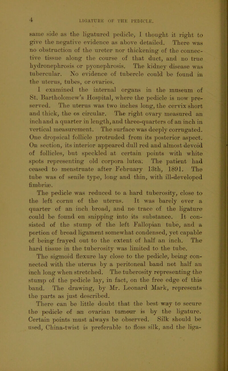 same side as the ligatured pedicle, 1 thought it right to give the negative evidence as above detailed. There was no obstruction of the ureter nor thickening of the connec- tive tissue along the course of that duct, and no true hydronephrosis or pyonephrosis. The kidney disease was tubercular. No evidence of tubercle could be found in the uterus, tubes, or ovaries. I examined the internal organs in the museum of St. Bartholomew’s Hospital, where the pedicle is now pre- served. The uterus was two inches long, the cervix short and thick, the os circular. The right ovary measured an inch and a quarter in length, and three-quarters of an inch in vertical measurement. The surface was deeply corrugated. One dropsical follicle protruded from its posterior aspect. On section, its interior appeared dull red and almost devoid of follicles, but speckled at certain points with white spots representing old corpora lutea. The patient had ceased to menstruate after February 13th, 1891, The tube was of senile type, long and thin, with ill-developed fimbriye. The pedicle was reduced to a hard tuberosity, close to the left cornu of the uterus. It was barely over a quarter of an inch broad, and no trace of the ligature could be found on snipping into its substance. It con- sisted of the stump of the left Fallopian tube, and a portion of broad ligament somewhat condensed, yet capable of being frayed out to the extent of half an inch. The hard tissue in the tuberosity was limited to the tube. The sigmoid flexure lay close to the pedicle, being con- nected with the uterus by a peritoneal band not half an inch long when stretched. The tuberosity representing the stump of the pedicle lay, in fact, on the free edge of this band. The drawing, by Mr. Leonard Mark, represents the parts as just described. There can be little doubt that the best way to secure the pedicle of an ovarian tumour is by the ligature. Certain points must always be observed. Silk should be used. China-twist is preferable to floss silk, and the liga-