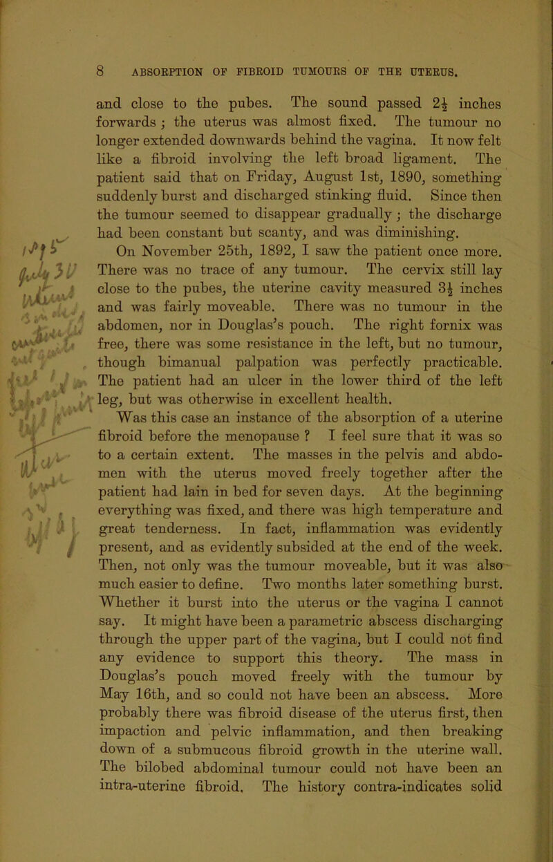 and close to the pubes. The sound passed 2| inches forwards ; the uterus was almost fixed. The tumour no longer extended downwards behind the vagina. It now felt like a fibroid involving the left broad ligament. The patient said that on Friday, August 1st, 1890, something suddenly burst and discharged stinking fluid. Since then the tumour seemed to disappear gradually ; the discharge had been constant but scanty, and was diminishing. On November 25th, 1892, I saw the patient once more. There was no trace of any tumour. The cervix still lay close to the pubes, the uterine cavity measured 3^ inches and was fairly moveable. There was no tumour in the abdomen, nor in Douglas’s pouch. The right fornix was free, there was some resistance in the left, but no tumour, though bimanual palpation was perfectly practicable. The patient had an ulcer in the lower third of the left leg, but was other-wise in excellent health. Was this case an instance of the absorption of a uterine fibroid before the menopause ? I feel sure that it was so to a certain extent. The masses in the pelvis and abdo- men with the uterus moved freely together after the patient had lain in bed for seven days. At the beginning everything was fixed, and there was high temperature and great tenderness. In fact, inflammation was evidently present, and as evidently subsided at the end of the week. Then, not only was the tumour moveable, but it was also much easier to define. Two months later something burst. Whether it burst into the uterus or the vagina I cannot say. It might have been a parametric abscess discharging through the upper part of the vagina, but I could not find any evidence to support this theory. The mass in Douglas’s pouch moved freely with the tumour by May 16th, and so could not have been an abscess. More probably there was fibroid disease of the uterus first, then impaction and pelvic inflammation, and then breaking down of a submucous fibroid growth in the uterine wall. The bilobed abdominal tumour could not have been an intra-uterine fibroid. The history contra-indicates solid
