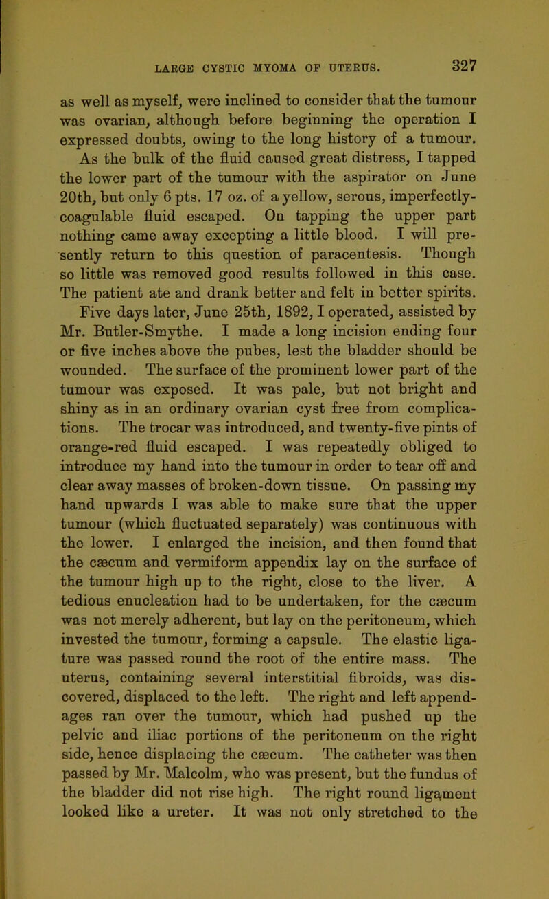 as well as myself, were inclined to consider that the tumour was ovarian, although before beginning the operation I expressed doubts, owing to the long history of a tnmour. As the bulk of the fluid caused great distress, I tapped the lower part of the tumour with the aspirator on June 20th, but only 6 pts. 17 oz. of a yellow, serous, imperfectly- coagulable fluid escaped. On tapping the upper part nothing came away excepting a little blood. I will pre- sently return to this question of paracentesis. Though so little was removed good results followed in this case. The patient ate and drank better and felt in better spirits. Five days later, June 25th, 1892,1 operated, assisted by Mr. Butler-Smythe. I made a long incision ending four or five inches above the pubes, lest the bladder should be wounded. The surface of the prominent lower part of the tumour was exposed. It was pale, but not bright and shiny as in an ordinary ovarian cyst free from complica- tions. The trocar was introduced, and twenty-five pints of orange-red fluid escaped. I was repeatedly obliged to introduce my hand into the tumour in order to tear off and clear away masses of broken-down tissue. On passing my hand upwards I was able to make sure that the upper tumour (which fluctuated separately) was continuous with the lower. I enlarged the incision, and then found that the caecum and vermiform appendix lay on the surface of the tumour high up to the right, close to the liver. A tedious enucleation had to be undertaken, for the caecum was not merely adherent, but lay on the peritoneum, which invested the tumour, forming a capsule. The elastic liga- ture was passed round the root of the entire mass. The uterus, containing several interstitial fibroids, was dis- covered, displaced to the left. The right and left append- ages ran over the tumour, which had pushed up the pelvic and iliac portions of the peritoneum on the right side, hence displacing the caecum. The catheter was then passed by Mr. Malcolm, who was present, but the fundus of the bladder did not rise high. The right round liga,ment looked like a ureter. It was not only stretched to the