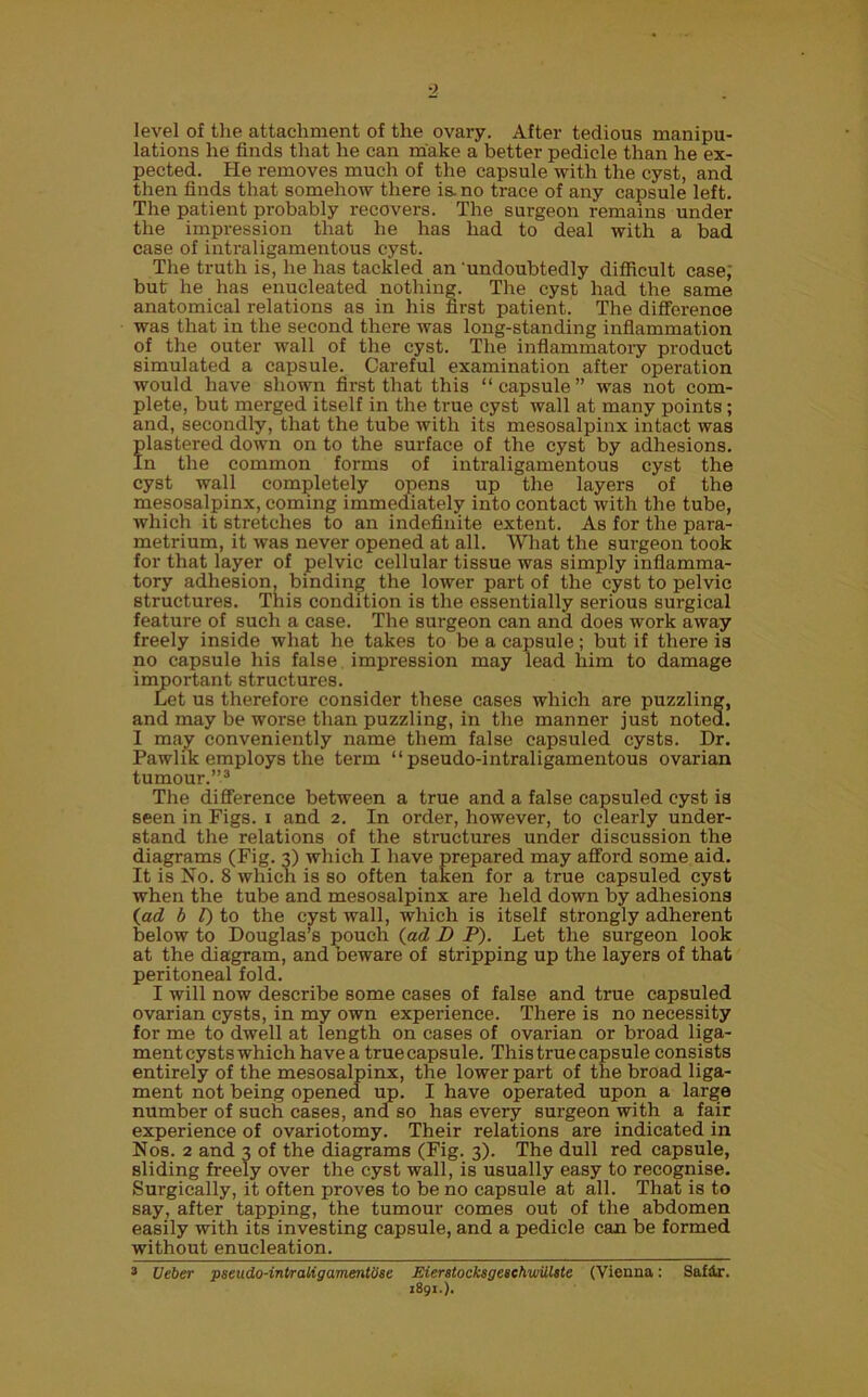 level of the attachment of the ovary. After tedious manipu- lations he finds that he can make a better pedicle than he ex- pected. He removes much of the capsule with the cyst, and then finds that somehow there is. no trace of any capsule left. The patient probably recovers. The surgeon remains under the impression that he has had to deal with a bad case of intraligamentous cyst. The truth is, he has tackled an 'undoubtedly difficult case; but he has enucleated nothing. The cyst had the same anatomical relations as in his first patient. The difference was that in the second there was long-standing inflammation of the outer wall of the cyst. The inflammatory product simulated a capsule. Careful examination after operation would have shown first that this “ capsule ” was not com- plete, but merged itself in the true cyst wall at many points; and, secondly, that the tube with its mesosalpinx intact was plastered down on to the surface of the cyst by adhesions. In the common forms of intraligamentous cyst the cyst wall completely opens up the layers of the mesosalpinx, coming immediately into contact with the tube, which it stretches to an indefinite extent. As for the para- metrium, it was never opened at all. What the surgeon took for that layer of pelvic cellular tissue was simply inflamma- tory adhesion, binding the lower part of the cyst to pelvic structures. This condition is the essentially serious surgical feature of such a case. The surgeon can and does work away freely inside what he takes to be a capsule; but if there is no capsule his false impression may lead him to damage important structures. Let us therefore consider these cases which are puzzling, and may be worse than puzzling, in the manner just noted. I may conveniently name them false capsuled cysts. Dr. Pawlik employs the term “pseudo-intraligamentous ovarian tumour.”3 The difference between a true and a false capsuled cyst is seen in Figs, i and 2. In order, however, to clearly under- stand the relations of the structures under discussion the diagrams (Fig. 3) which I have prepared may afford some aid. It is No. 8 which is so often taken for a true capsuled cyst when the tube and mesosalpinx are held down by adhesions {ad b 1) to the cyst wall, which is itself strongly adherent below to Douglas’s pouch {ad D P). Let the surgeon look at the diagram, and beware of stripping up the layers of that peritoneal fold. I will now describe some cases of false and true capsuled ovarian cysts, in my own experience. There is no necessity for me to dwell at length on cases of ovarian or broad liga- ment cysts which have a true capsule. This true capsule consists entirely of the mesosalpinx, the lower part of the broad liga- ment not being opened up. I have operated upon a large number of such cases, and so has every surgeon with a fair experience of ovariotomy. Their relations are indicated in Nos. 2 and 3 of the diagrams (Fig. 3). The dull red capsule, sliding freely over the cyst wall, is usually easy to recognise. Surgically, it often proves to be no capsule at all. That is to say, after tapping, the tumour comes out of the abdomen easily with its investing capsule, and a pedicle can be formed without enucleation. 3 Ueber pseudo-inbraligamentose Eierstocksgeschwiilste (Vienna: Safir. 1891.).