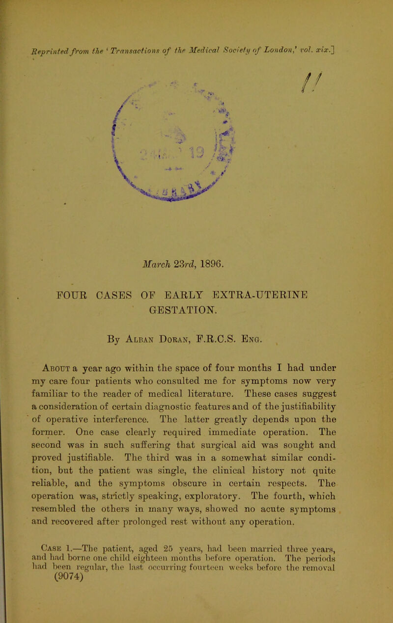 Reprinted from the ' Transactions of the Medical Society of London,' rol. xix.'] March 2Zrd, 1896. FOUR CASES OF EARLY EXTRA-UTERTNE GESTATION. By Alban Doran, F.R.C.S. Eng. , About a year ago witliin the space of four months I had under my care four patients who consulted me for symptoms now very familiar to the reader of medical literature. These cases suggest a consideration of certain diagnostic features and of the justifiability of operative interference. The latter greatly depends upon the former. One case clearly required immediate operation. The second was in such sufi:ering that surgical aid was sought and proved justifiable. The third was in a somewhat similar condi- tion, but the patient was single, the clinical history not quite reliable, and the symptoms obscure in certain respects. The operation was, strictly speaking, exploratory. The fourth, which resembled the others in many ways, showed no acute symptoms and recovered after prolonged rest without any operation. Case 1.—The patient, aged 25 yeai’s, had been married three years, and had borne one child eighteen months l)efore operation. The periods had been regular, the la.st occurring fourteen weeks before the removal (9074)
