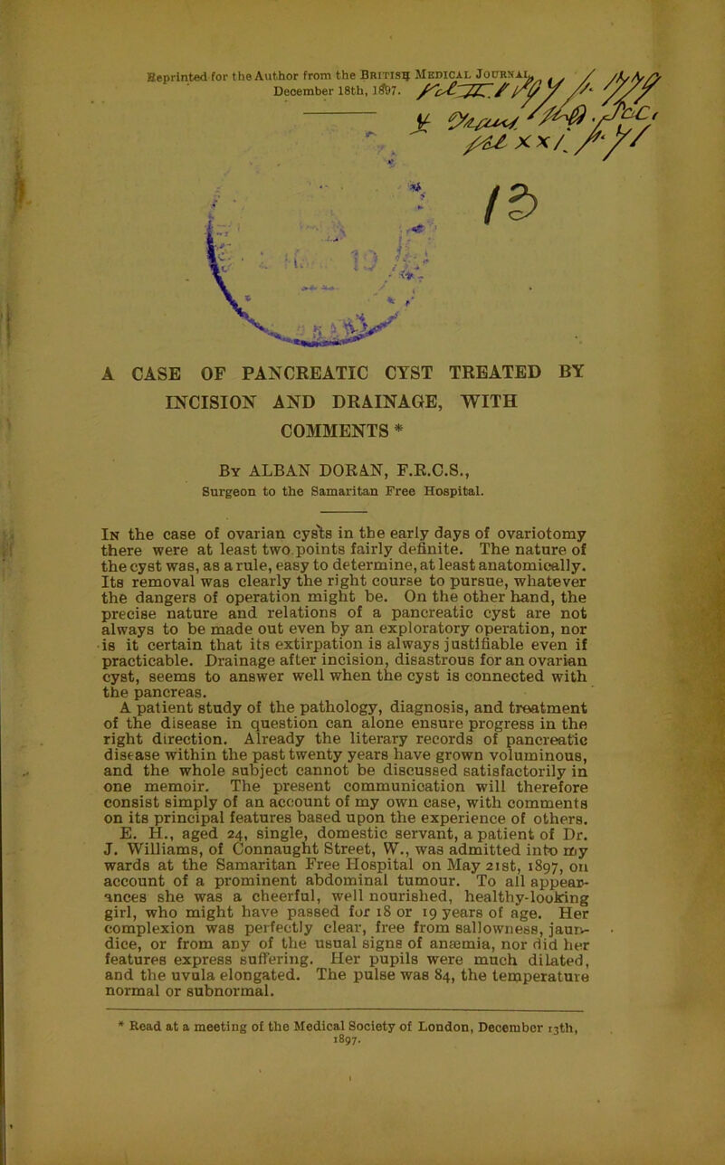 Reprinted for the Author from the British Medical Journa December 18th, 1$97. Jf x x/. A CASE OF PANCREATIC CYST TREATED BY INCISION AND DRAINAGE, WITH COMMENTS * By ALBAN DORAN, F.R.C.S., Surgeon to the Samaritan Free Hospital. In the case of ovarian cys'ts in the early days of ovariotomy there were at least two, points fairly definite. The nature of the cyst was, as a rule, easy to determine, at least anatomically. Its removal was clearly the right course to pursue, whatever the dangers of operation might be. On the other hand, the precise nature and relations of a pancreatic cyst are not always to be made out even by an exploratory operation, nor is it certain that its extirpation is always justifiable even if practicable. Drainage after incision, disastrous for an ovarian cyst, seems to answer well when the cyst is connected with the pancreas. A patient study of the pathology, diagnosis, and treatment of the disease in question can alone ensure progress in the right direction. Already the literary records of pancreatic disease within the past twenty years have grown voluminous, and the whole subject cannot be discussed satisfactorily in one memoir. The present communication will therefore consist simply of an account of my own case, with comments on its principal features based upon the experience of others. E. H., aged 24, single, domestic servant, a patient of Dr. J. Williams, of Connaught Street, W., was admitted into my wards at the Samaritan Free Hospital on May 21st, 1897, on account of a prominent abdominal tumour. To all appear- ances she was a cheerful, well nourished, healthy-looking girl, who might have passed for 18 or 19 years of age. Her complexion was perfectly clear, free from sallowness, jaun- dice, or from any of the usual signs of anaemia, nor did her features express suffering. Her pupils were much dilated, and the uvula elongated. The pulse was 84, the temperature normal or subnormal. Read at a meeting of the Medical Society of London, December 13th, 1897.