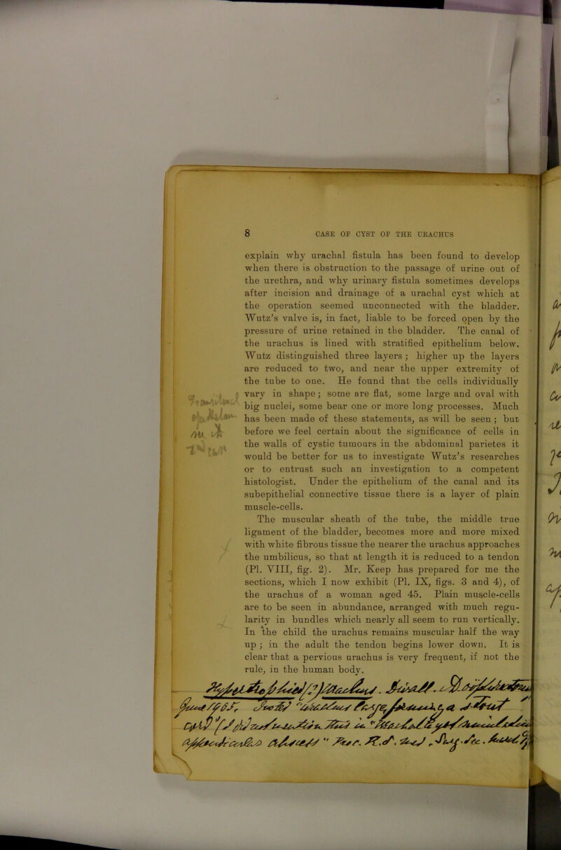 /Ha tv)1 v explain why urachal fistula has been found to develop when there is obstruction to the passage of urine out of the urethra, and why urinary fistula sometimes develops after incision and drainage of a urachal cyst which at the operation seemed unconnected with the bladder. Wutz’s valve is, in fact, liable to be forced open by the pressure of urine retained in the bladder. The canal of the urachus is lined with stratified epithelium below. Wutz distinguished three layers ; higher up the layers are reduced to two, and near the upper extremity of the tube to one. He found that the cells individually vary in shape; some are flat, some large and oval with big nuclei, some bear one or more long processes. Much has been made of these statements, as will be seen ; but before we feel certain about the significance of cells in the walls of cystic tumours in the abdominal pai’ietes it would be better for us to investigate Wutz’s researches or to entrust such an investigation to a competent histologist. Under the epithelium of the canal and its subepithelial connective tissue there is a layer of plain muscle-cells. The muscular sheath of the tube, the middle true ligament of the bladder, becomes more and more mixed with white fibrous tissue the nearer the urachus approaches the umbilicus, so that at length it is reduced to a tendon (PI. VIII, fig. 2). Mr. Keep has prepared for me the sections, which I now exhibit (PI. IK, figs. 3 and 4), of the urachus of a woman aged 45. Plain muscle-cells are to be seen in abundance, arranged with much regu- larity in bundles which nearly all seem to run vertically. In the child the urachus remains muscular half the way up ; in the adult the tendon begins lower down. It is clear that a pervious urachus is very frequent, if not the rule, in the human body. s&w' . 6*4^/A