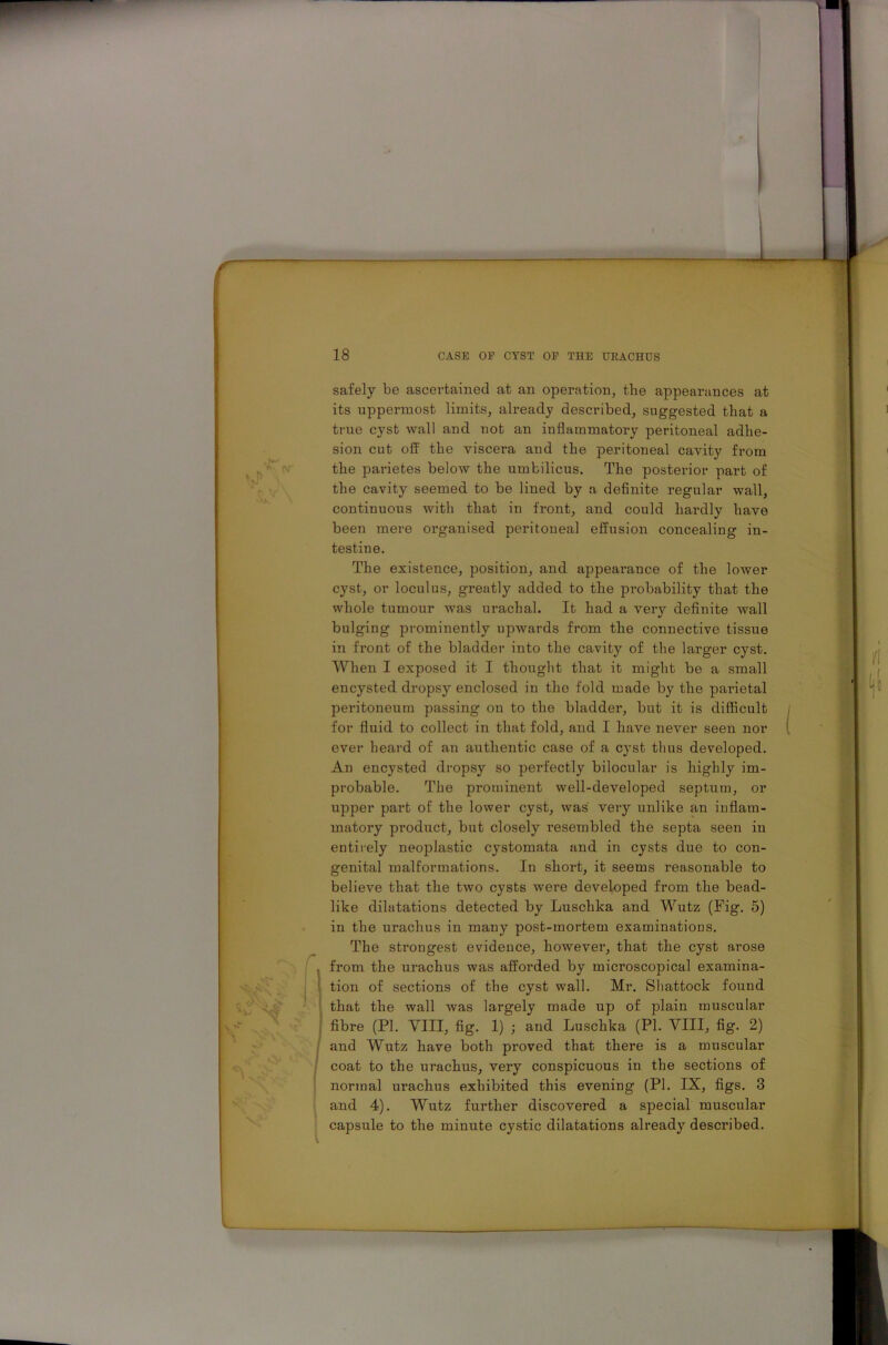 safely be ascertained at an operation, tlie appearances at its uppermost limits, already described, suggested that a true cyst wall and not an inflammatory peritoneal adhe- sion cut oft- the viscera and the peritoneal cavity from the parietes below the umbilicus. The posterior part of the cavity seemed to be lined by a definite regular wall, continuous with that in front, and could hardly have been mere organised peritoneal effusion concealing in- testine. The existence, position, and appearance of the lower cyst, or loculus, greatly added to the probability that the whole tumour was urachal. It had a very definite wall bulging prominently upwards from the connective tissue in front of the bladder into the cavity of the larger cyst. When I exposed it I thought that it might be a small encysted dropsy enclosed in the fold made by the parietal peritoneum passing on to the bladder, but it is difficult for fluid to collect in that fold, and I have never seen nor ever heard of an authentic case of a cyst thus developed. An encysted dropsy so pei’fectly bilocular is highly im- probable. The prominent well-developed septum, or upper part of the lower cyst, was very unlike an inflam- matory product, but closely resembled the septa seen in entirely neoplastic cystomata and in cysts due to con- genital malformations. In short, it seems reasonable to believe that the two cysts were developed from the bead- like dilatations detected by Luschka and Wutz (Fig. 5) in the urachus in many post-mortem examinations. The strongest evidence, however, that the cyst arose from the urachus was afforded by microscopical examina- tion of sections of the cyst wall. Mr. Shattock found that the wall was largely made up of plain muscular fibre (PI. VIII, fig. 1) ; and Luschka (PI. VIII, fig. 2) and Wutz have both proved that there is a muscular coat to the urachus, very conspicuous in the sections of normal urachus exhibited this evening (PI. IX, figs. 3 and 4). Wutz further discovered a special muscular capsule to the minute cystic dilatations already described.