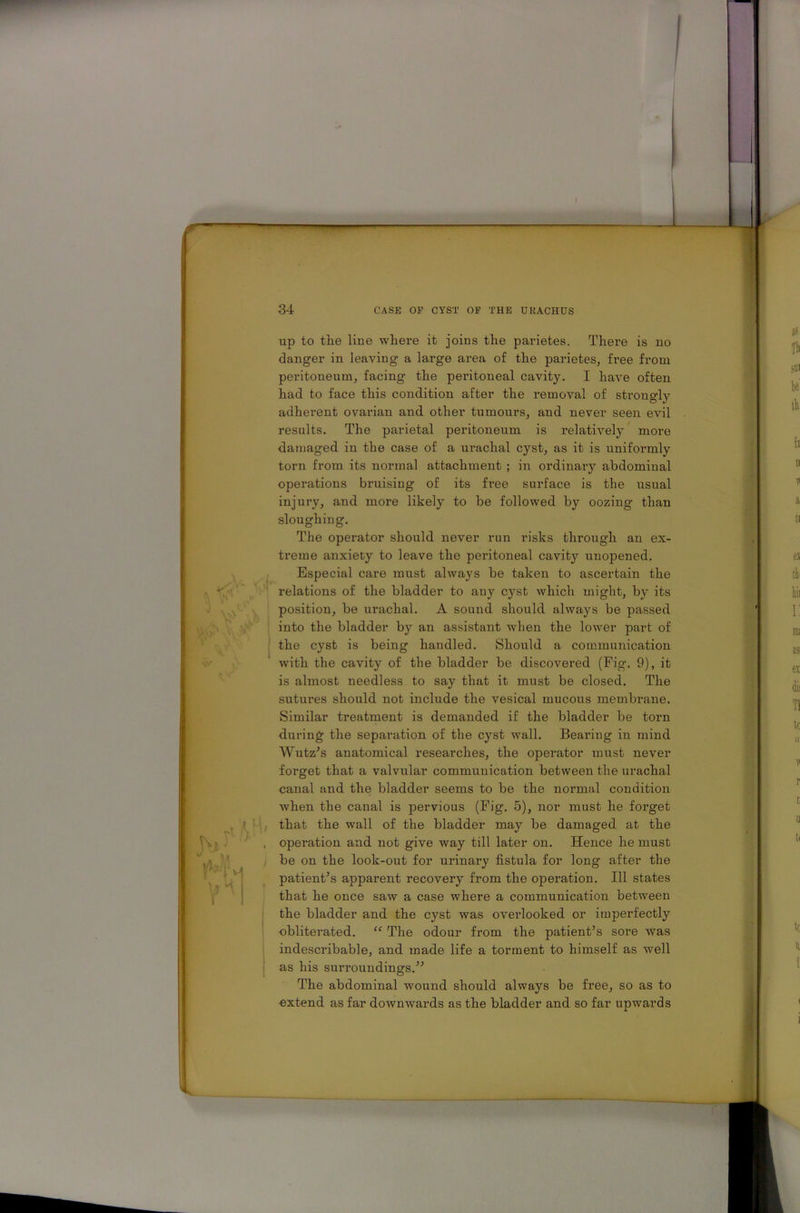up to the line where it joins the parietes. There is no danger in leaving a large area of the parietes, free from peritoneum, facing the peritoneal cavity. I have often had to face this condition after the removal of strongly adherent ovarian and other tumours, and never seen evil results. The parietal peritoneum is relatively more damaged in the case of a urachal cyst, as it is uniformly torn from its normal attachment ; in ordinary abdominal operations bruising of its fi-ee surface is the usual injury, and more likely to be followed by oozing than sloughing. The operator should never run risks through an ex- treme anxiety to leave the peritoneal cavity unopened. Especial care must always be taken to ascertain the relations of the bladder to any cyst which might, by its position, be urachal. A sound should always be passed into the bladder by an assistant when the lower part of the cyst is being handled. Should a communication with the cavity of the bladder be discovered (Fig. 9), it is almost needless to say that it must be closed. The sutures should not include the vesical mucous membi’ane. Similar treatment is demanded if the bladder be torn during the separation of the cyst wall. Bearing in mind Wutz’s anatomical researches, the operator must never forget that a valvular communication between the urachal canal and the bladder seems to be the normal condition when the canal is pervious (Fig. 5), nor must he forget that the wall of the bladder may be damaged at the operation and not give way till later on. Hence he must be on the look-out for urinary fistula for long after the patient’s apparent recovery from the operation. Ill states that he once saw a case where a communication between the bladder and the cyst was overlooked or imperfectly obliterated. “ The odour from the patient’s sore was indescribable, and made life a torment to himself as well as his surroundings.” The abdominal wound should always be free, so as to ■extend as far downwards as the bladder and so far upwards